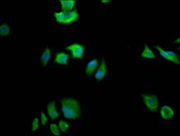 Immunofluorescence staining of Hela Cells with CSB-RA240595A0HU at 1:50, counter-stained with DAPI. The cells were fixed in 4% formaldehyde, permeated by 0.2% TritonX-100, and blocked in 10% normal Goat Serum. The cells were then incubated with the antibody overnight at 4℃. Nuclear DNA was labeled in blue with DAPI. The secondary antibody was FITC-conjugated AffiniPure Goat Anti-Rabbit IgG (H+L).