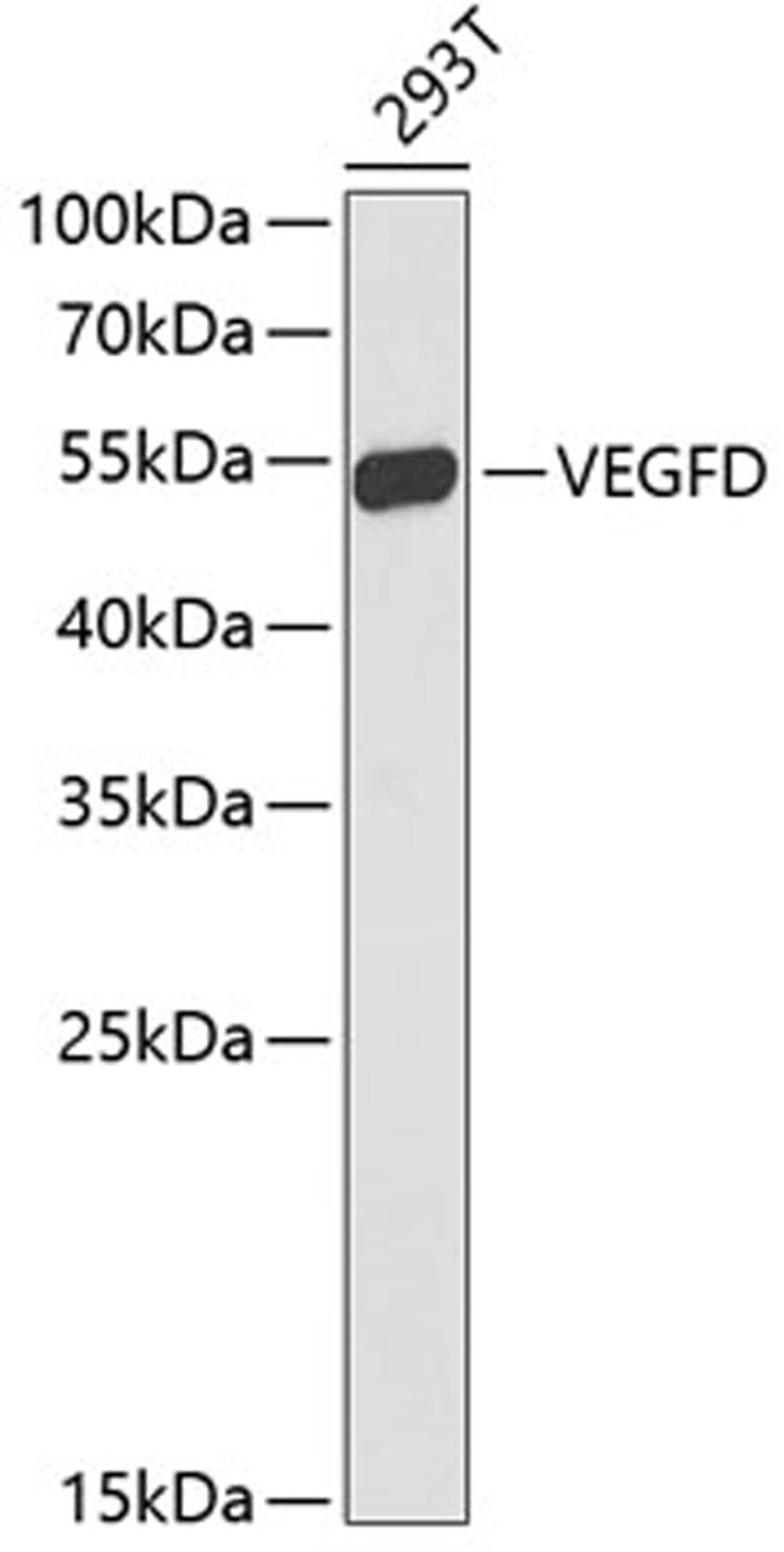 Western blot - VEGFD antibody (A13617)