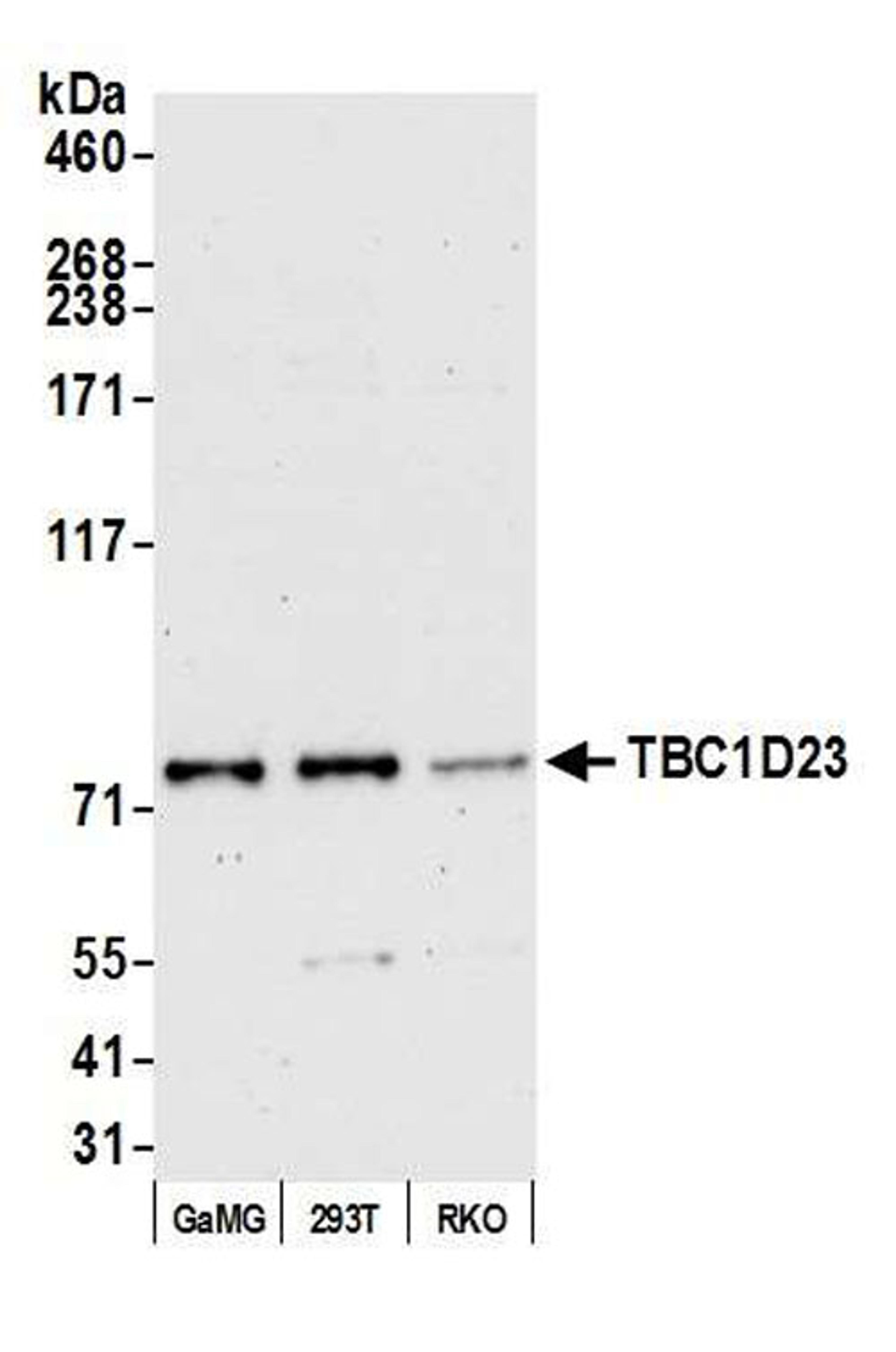 Detection of human TBC1D23 by WB.