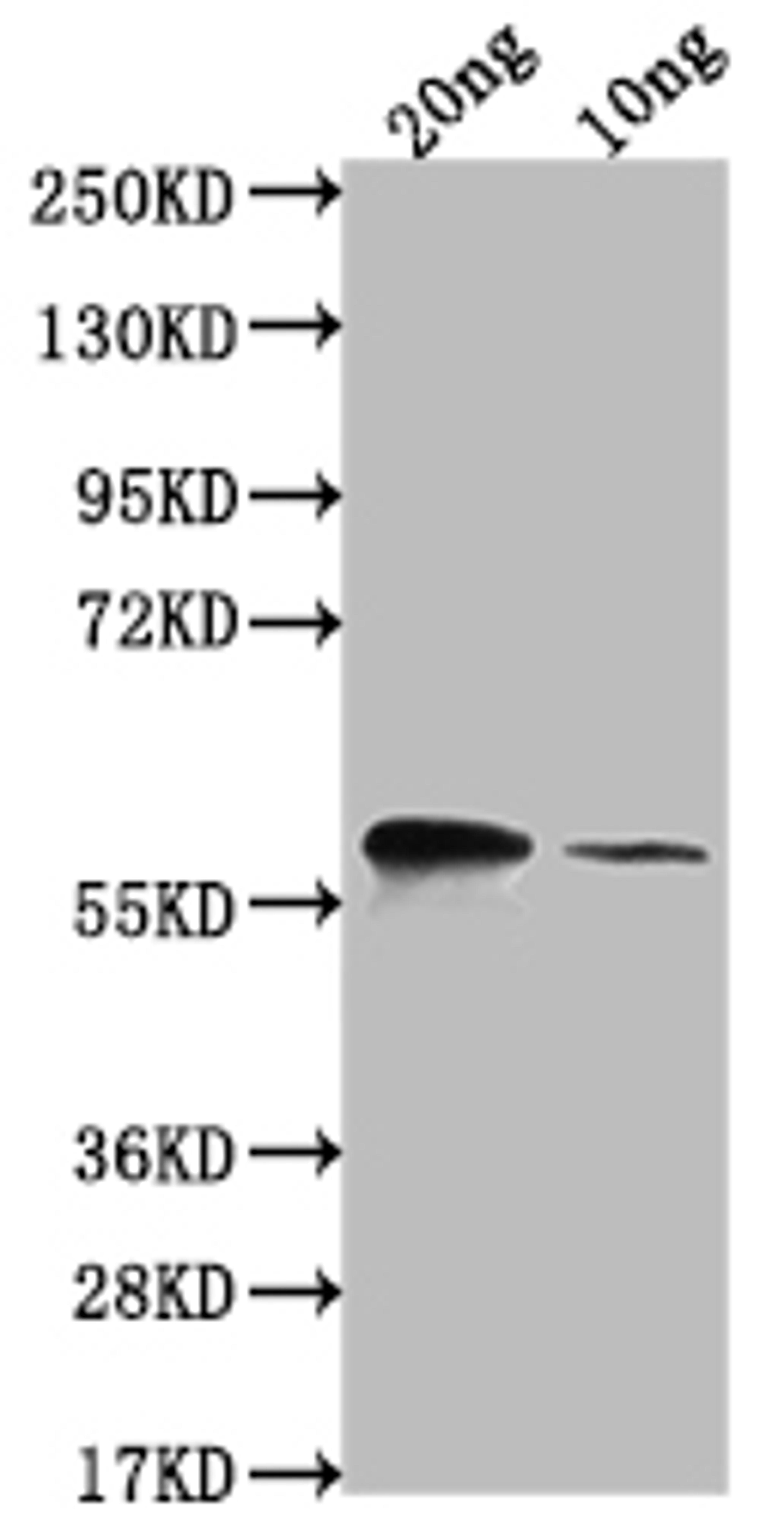 Western Blot. Positive WB detected in Recombinant protein. All lanes: omp38 antibody at 1:2000. Secondary. Goat polyclonal to rabbit IgG at 1/50000 dilution. Predicted band size: 52.5 kDa. Observed band size: 66 kDa.