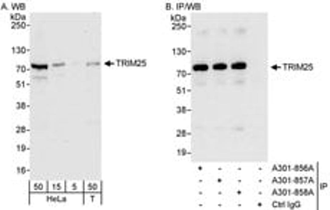 Detection of human TRIM25 by western blot and immunoprecipitation.