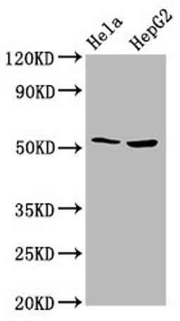 Western Blot. Positive WB detected in: Hela whole cell lysate, HepG2 whole cell lysate. All lanes: THNSL2 antibody at 4.3ug/ml. Secondary. Goat polyclonal to rabbit IgG at 1/50000 dilution. Predicted band size: 55, 46, 43, 48, 28 kDa. Observed band size: 55 kDa. 