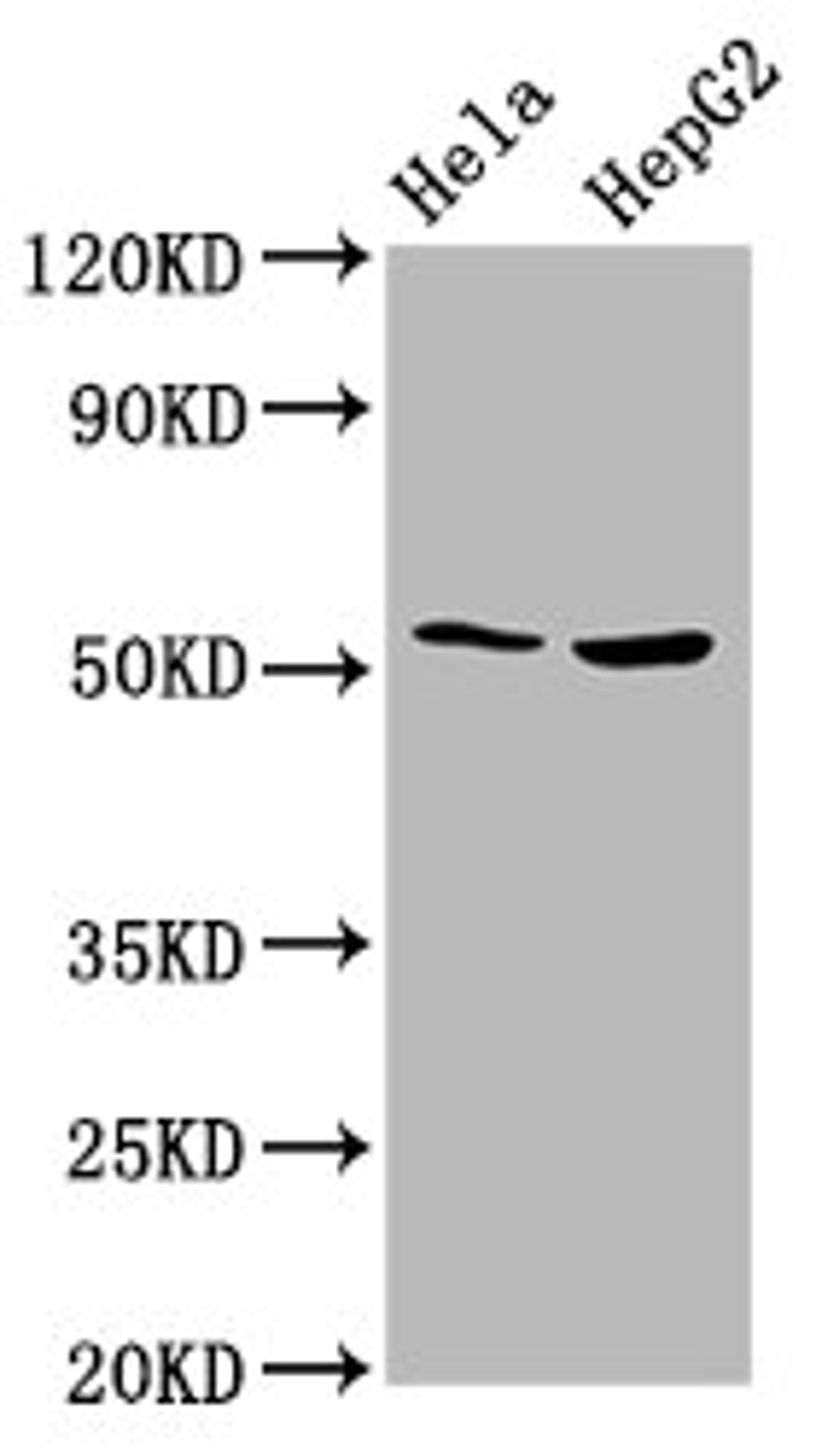 Western Blot. Positive WB detected in: Hela whole cell lysate, HepG2 whole cell lysate. All lanes: THNSL2 antibody at 4.3ug/ml. Secondary. Goat polyclonal to rabbit IgG at 1/50000 dilution. Predicted band size: 55, 46, 43, 48, 28 kDa. Observed band size: 55 kDa. 