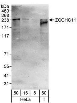 Detection of human ZCCHC11 by western blot.