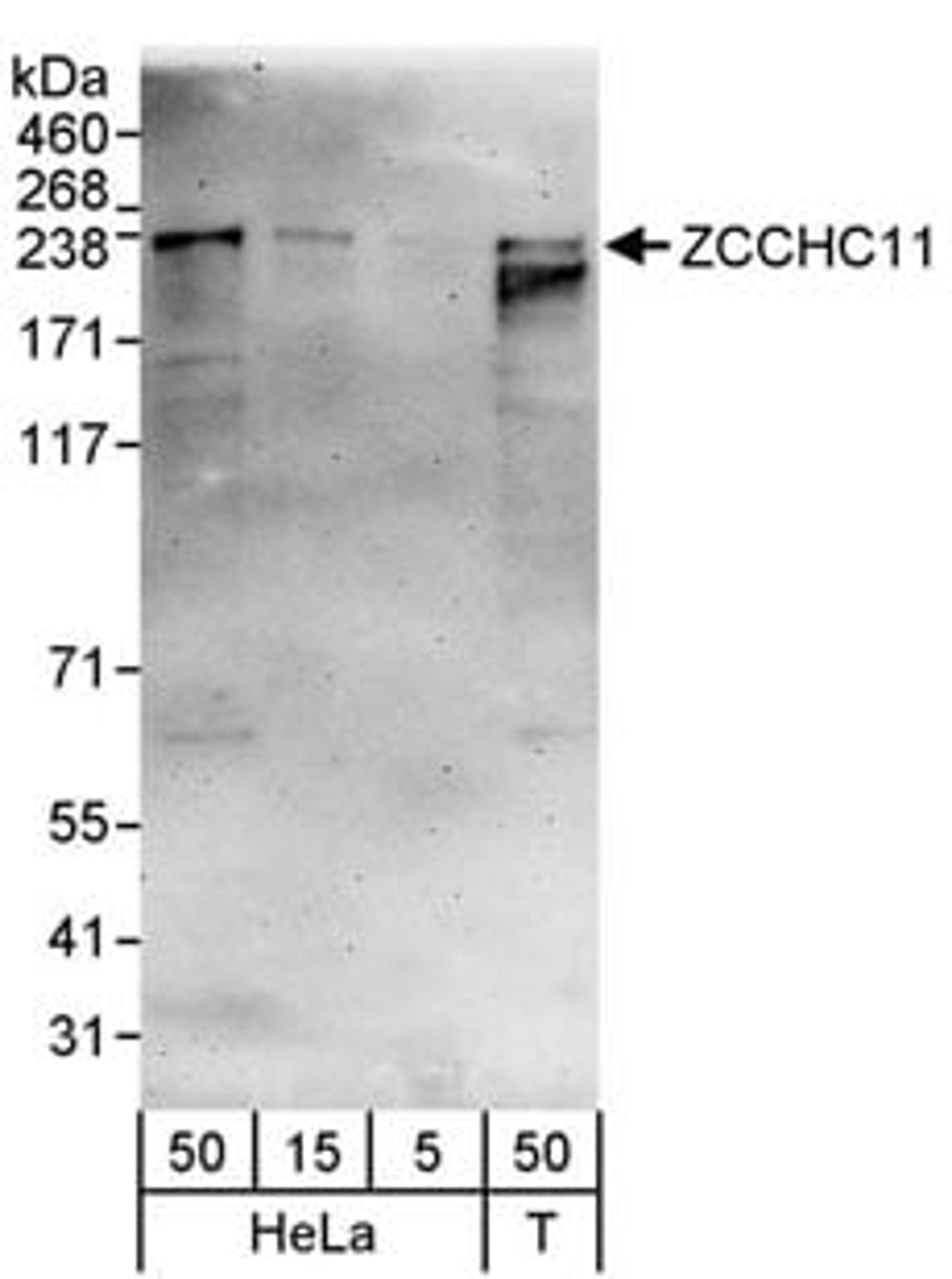 Detection of human ZCCHC11 by western blot.