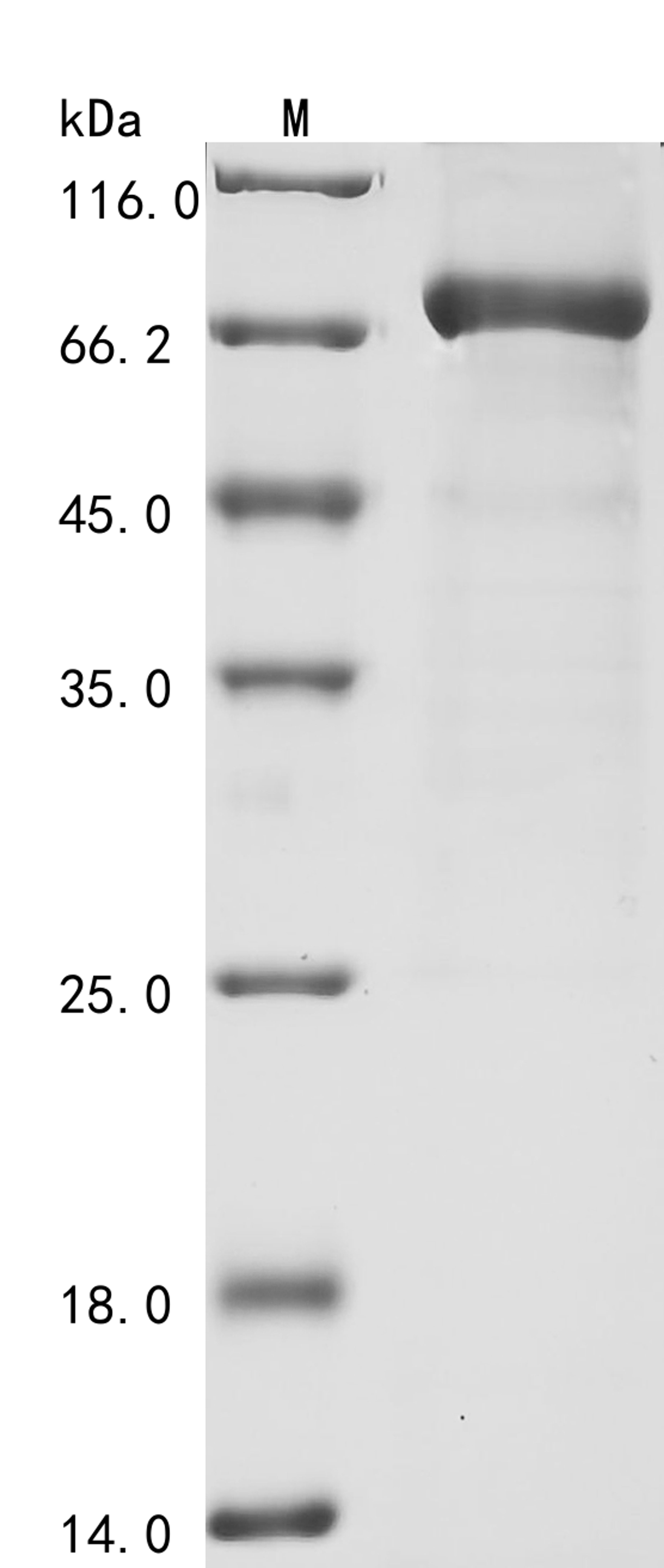 (Tris-Glycine gel) Discontinuous SDS-PAGE (reduced) with 5% enrichment gel and 15% separation gel.