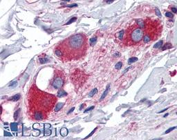 45-715 (3.75ug/ml) staining of paraffin embedded Human Small Intestine. Steamed antigen retrieval with citrate buffer pH 6, AP-staining.