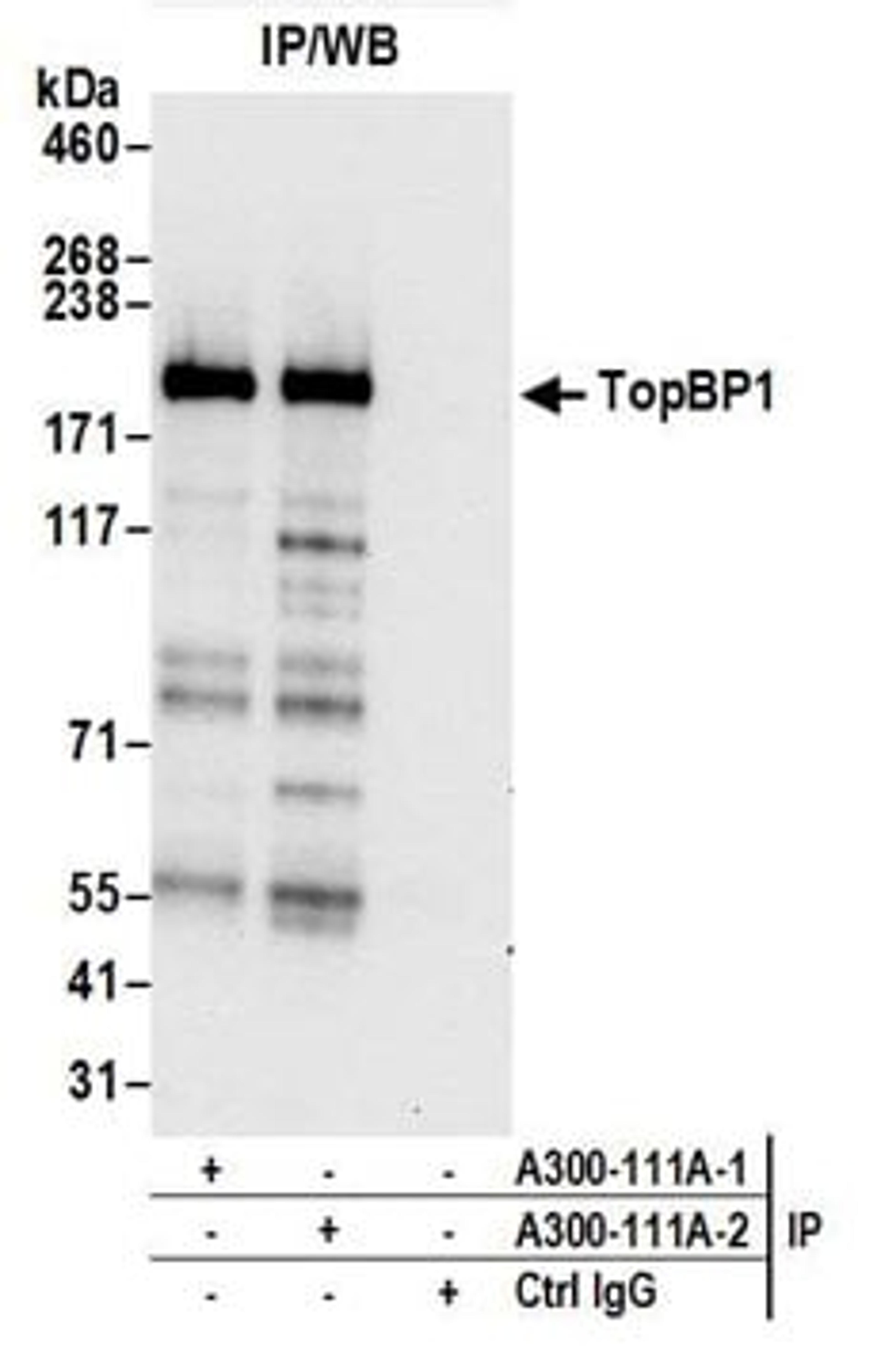 Detection of human TopBP1 by western blot of immunoprecipitates.