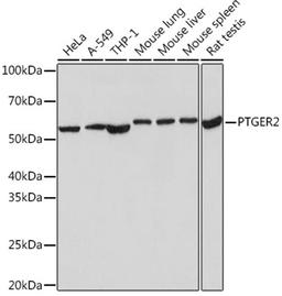 Western blot - PTGER2 Rabbit mAb (A9053)