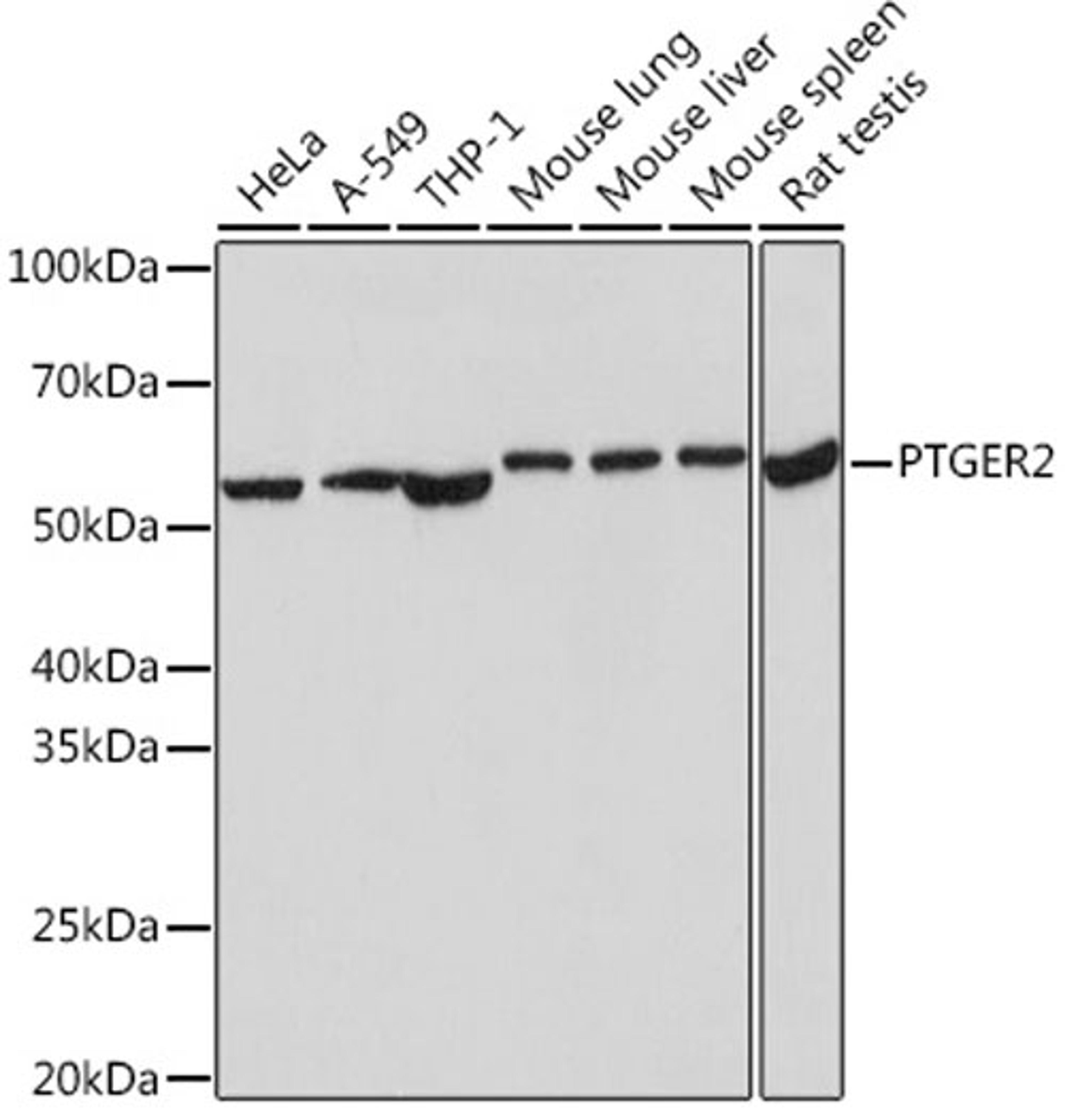 Western blot - PTGER2 Rabbit mAb (A9053)