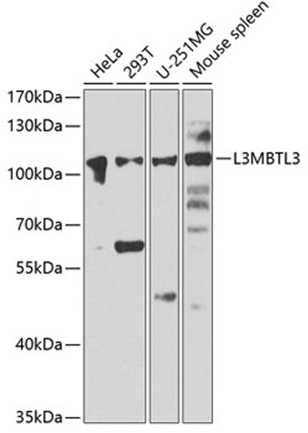 Western blot - L3MBTL3 antibody (A7289)