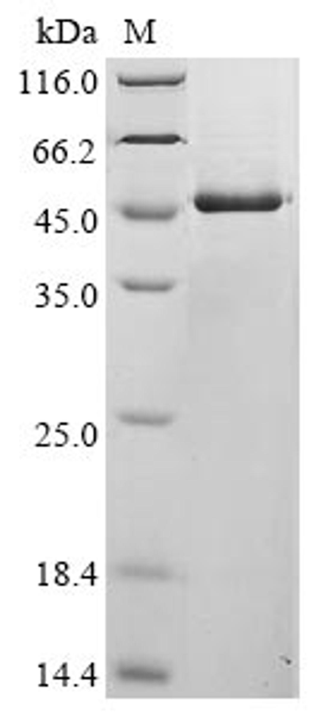 (Tris-Glycine gel) Discontinuous SDS-PAGE (reduced) with 5% enrichment gel and 15% separation gel.