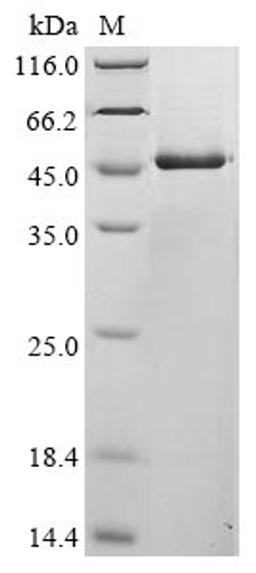 (Tris-Glycine gel) Discontinuous SDS-PAGE (reduced) with 5% enrichment gel and 15% separation gel.