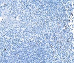 Detection of human LAG3 by immunohistochemistry.