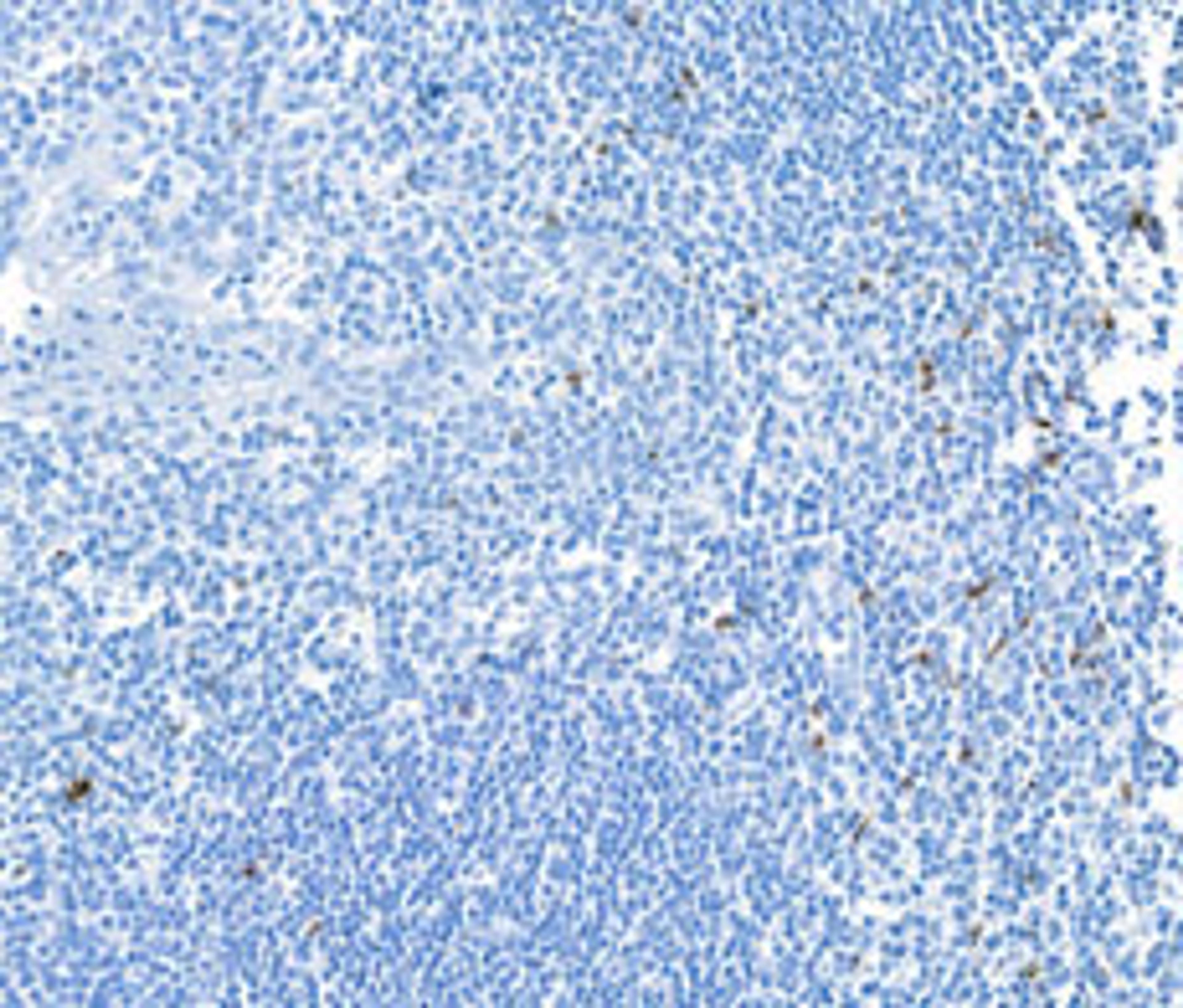 Detection of human LAG3 by immunohistochemistry.