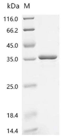 (Tris-Glycine gel) Discontinuous SDS-PAGE (reduced) with 5% enrichment gel and 15% separation gel.
