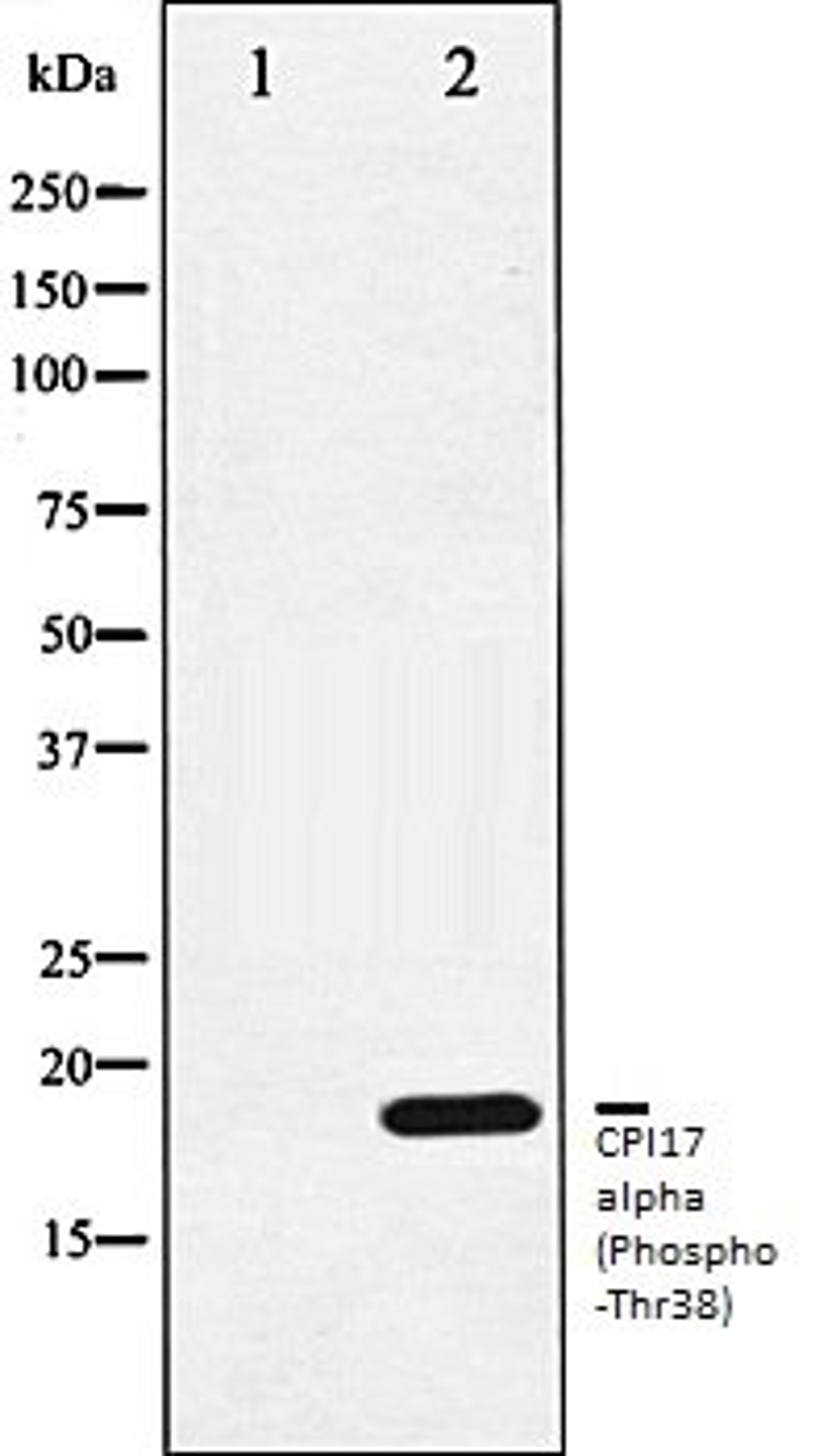 Western blot analysis of RAW264.7 whole cell lysates using CPI17 alpha (Phospho-Thr38) antibody, The lane on the left is treated with the antigen-specific peptide.