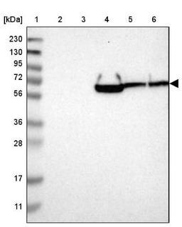 Western Blot: GRAMD1A Antibody [NBP1-93730] - Lane 1: Marker [kDa] 230, 130, 95, 72, 56, 36, 28, 17, 11<br/>Lane 2: Human cell line RT-4<br/>Lane 3: Human cell line U-251MG sp<br/>Lane 4: Human plasma (IgG/HSA depleted)<br/>Lane 5: Human liver tissue<br/>Lane 6: Human tonsil tissue