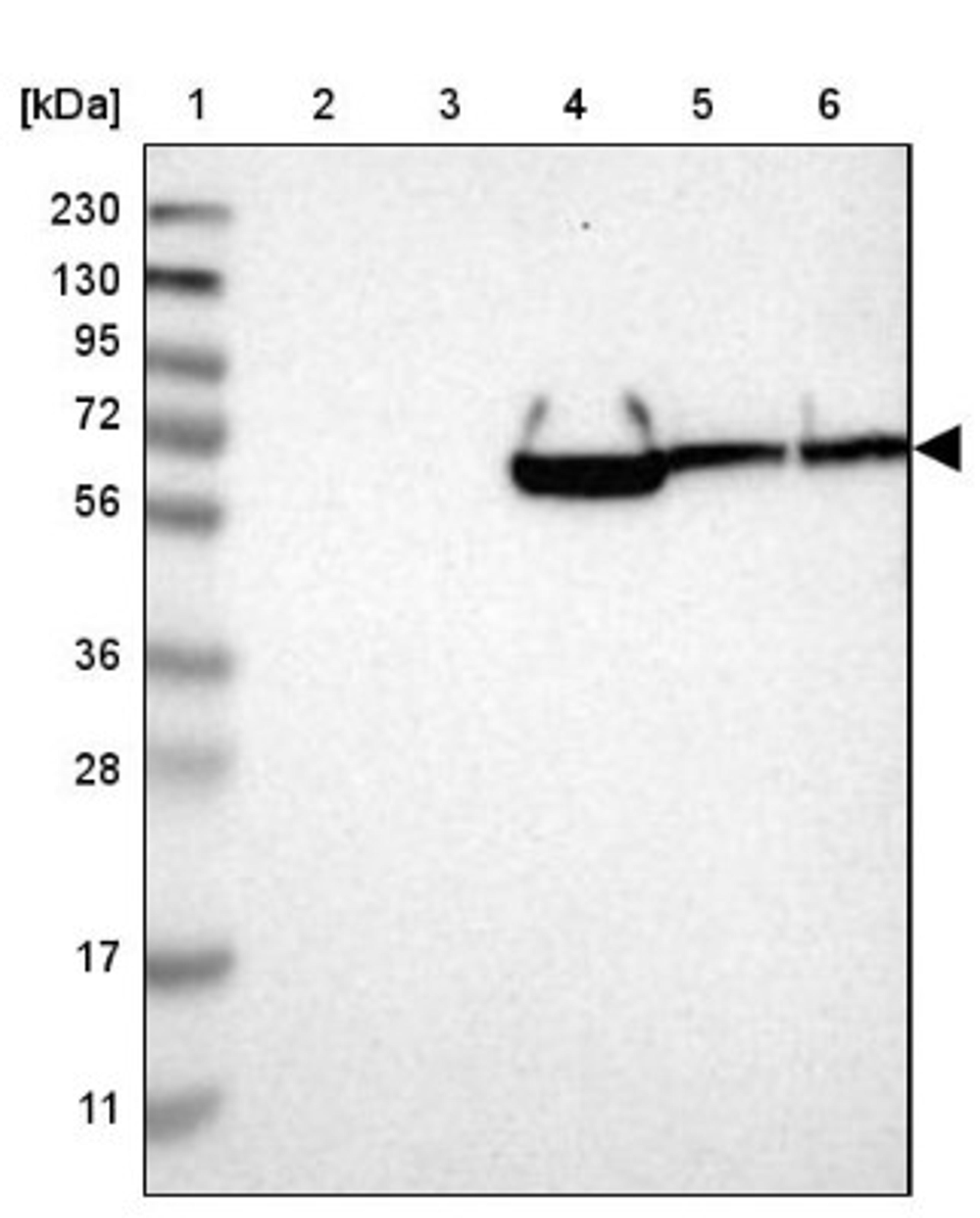 Western Blot: GRAMD1A Antibody [NBP1-93730] - Lane 1: Marker [kDa] 230, 130, 95, 72, 56, 36, 28, 17, 11<br/>Lane 2: Human cell line RT-4<br/>Lane 3: Human cell line U-251MG sp<br/>Lane 4: Human plasma (IgG/HSA depleted)<br/>Lane 5: Human liver tissue<br/>Lane 6: Human tonsil tissue