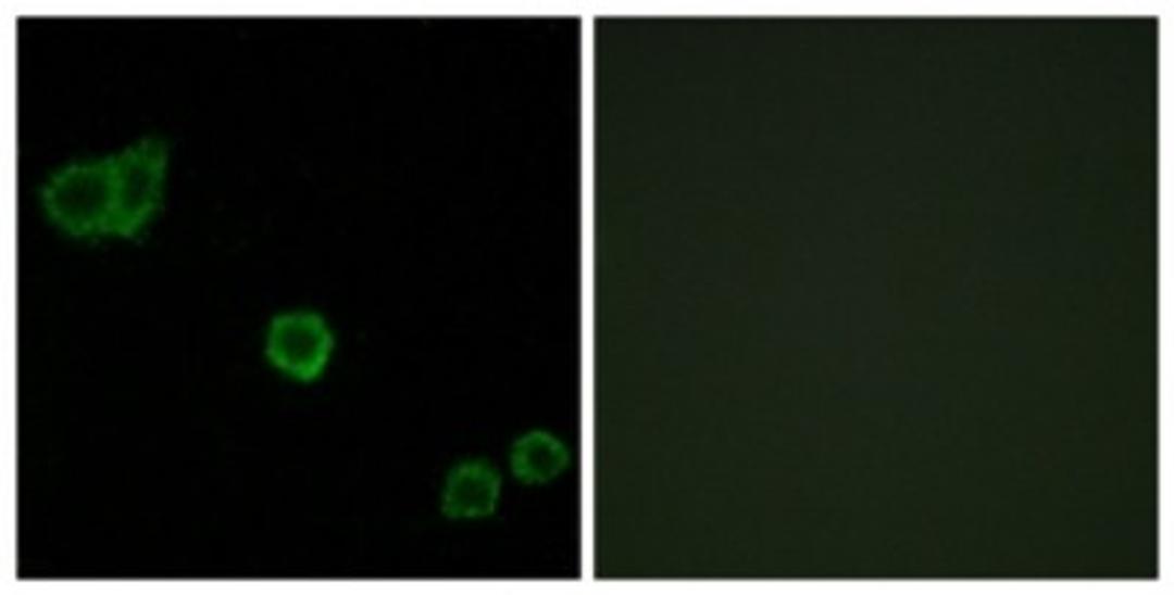 Immunocytochemistry/Immunofluorescence: CPI17 alpha Antibody [NBP1-61843] - Analysis of HeLa cells, using CPI17 alpha  Antibody. The picture on the right is treated with the synthesized peptide.