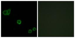 Immunocytochemistry/Immunofluorescence: CPI17 alpha Antibody [NBP1-61843] - Analysis of HeLa cells, using CPI17 alpha  Antibody. The picture on the right is treated with the synthesized peptide.