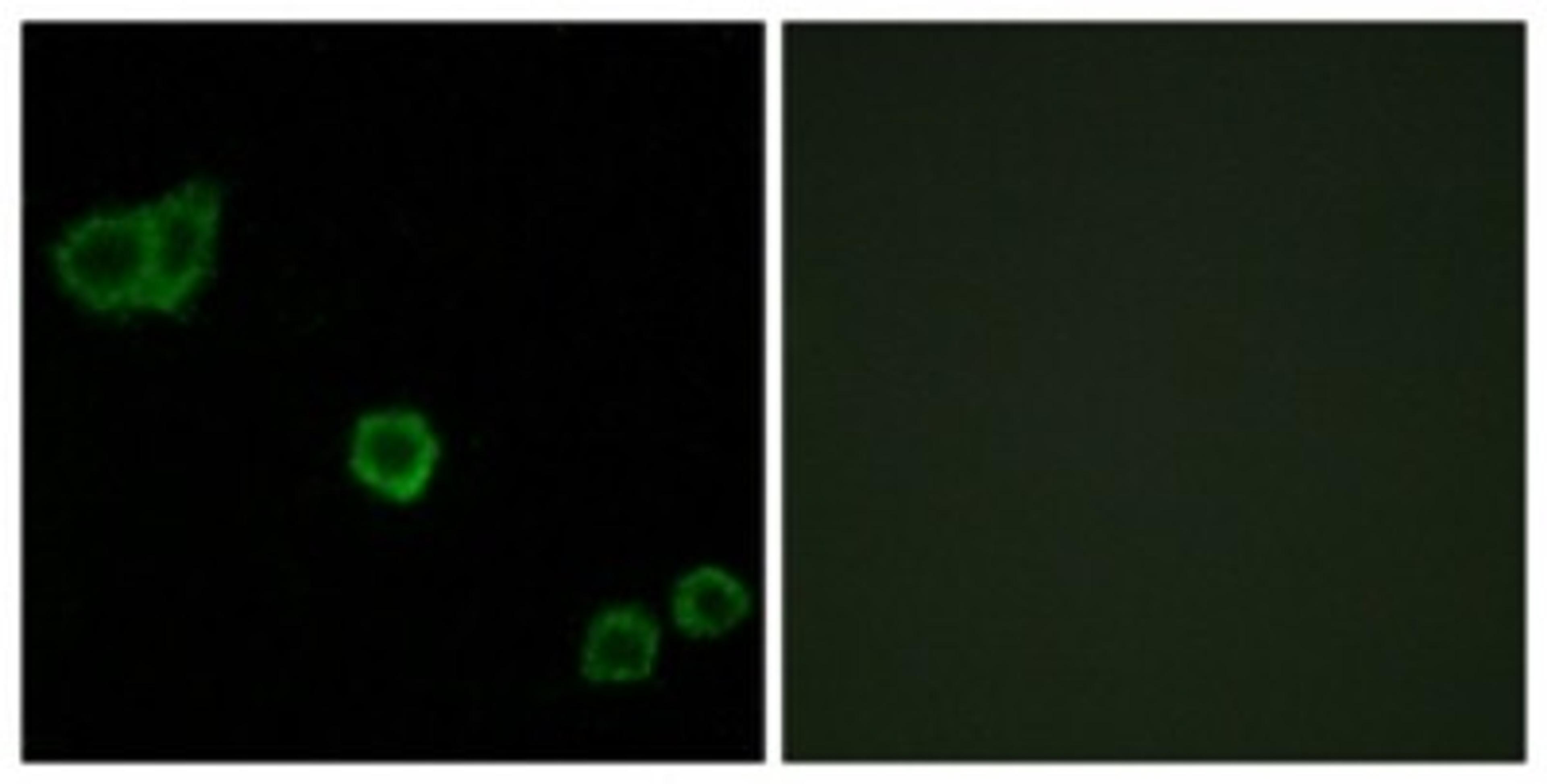 Immunocytochemistry/Immunofluorescence: CPI17 alpha Antibody [NBP1-61843] - Analysis of HeLa cells, using CPI17 alpha  Antibody. The picture on the right is treated with the synthesized peptide.