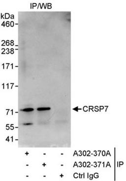 Detection of human CRSP7 by western blot of immunoprecipitates.