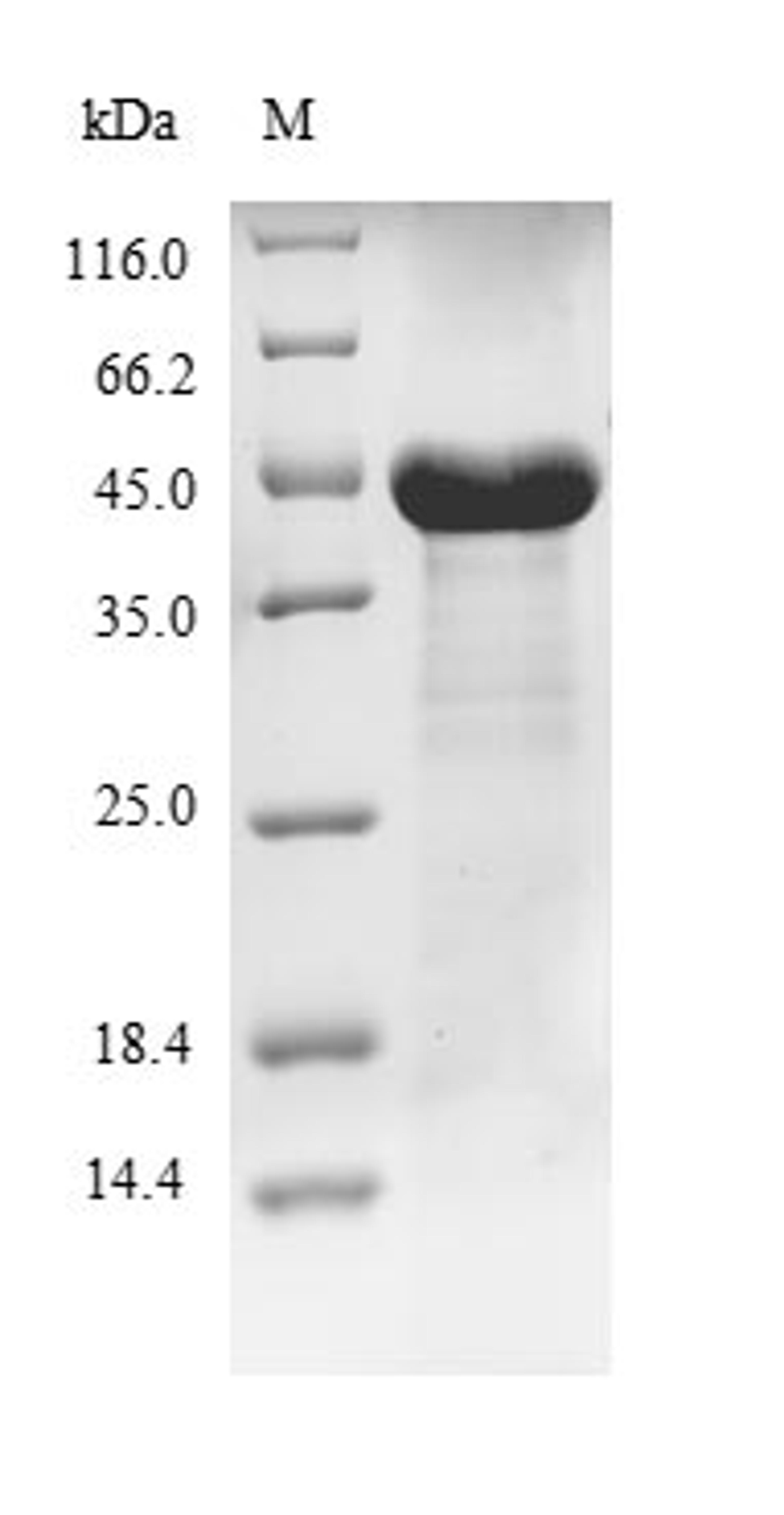 (Tris-Glycine gel) Discontinuous SDS-PAGE (reduced) with 5% enrichment gel and 15% separation gel.