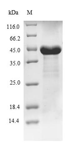 (Tris-Glycine gel) Discontinuous SDS-PAGE (reduced) with 5% enrichment gel and 15% separation gel.