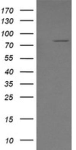 Western Blot: Solo Antibody (2E7) [NBP2-45789] - Analysis of HEK293T cells were transfected with the pCMV6-ENTRY control (Left lane) or pCMV6-ENTRY Solo.