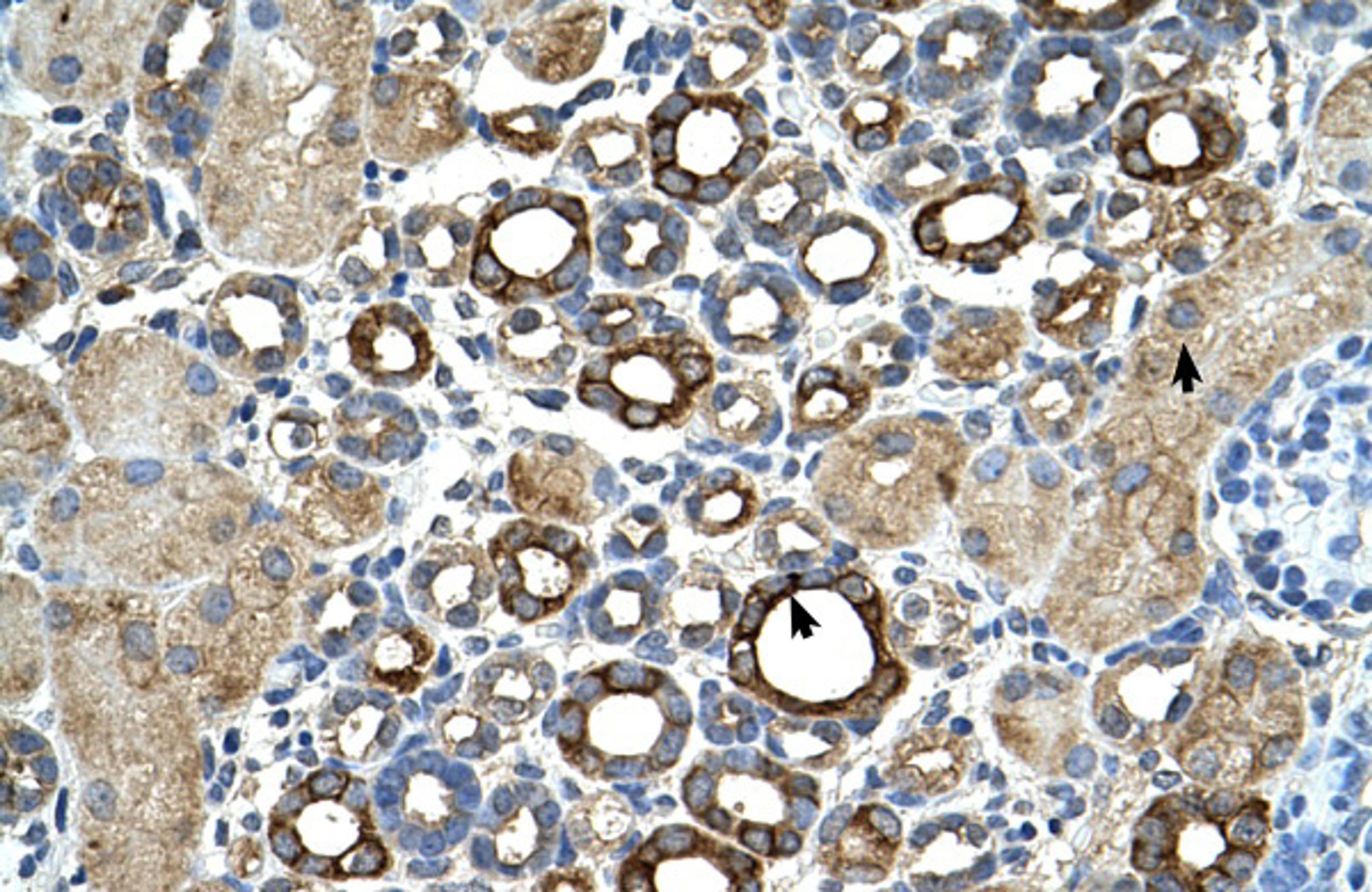 Antibody used in IHC on Human kidney.