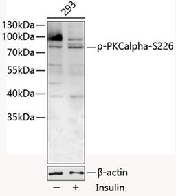 Western blot - Phospho-PKCalpha-S226 antibody (AP0559)