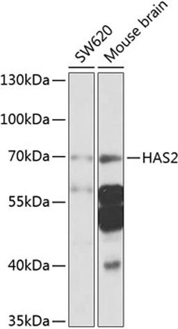 Western blot - HAS2 antibody (A9897)