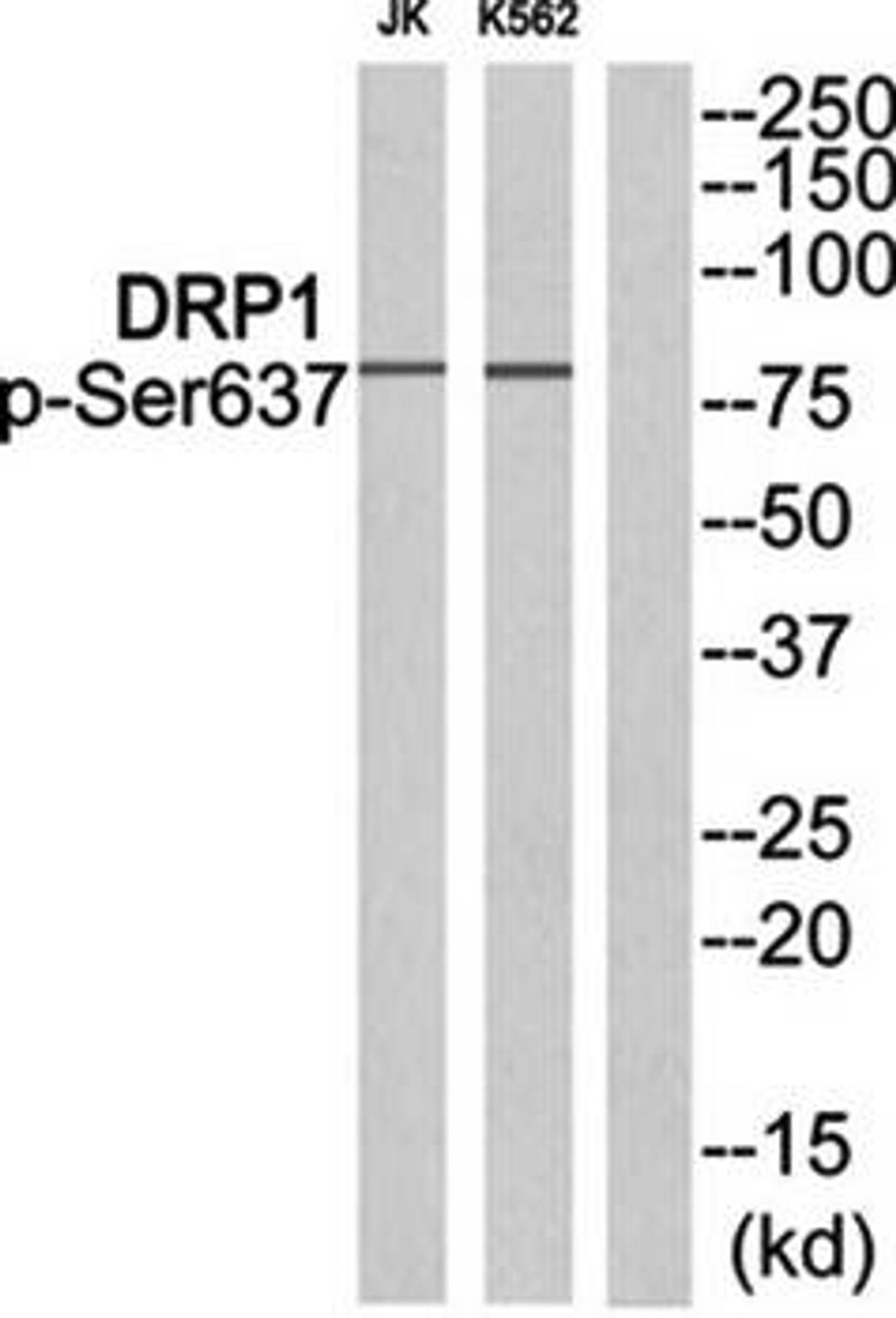 Western blot analysis of extracts from JK cells and K562 cells using DRP1 (phospho-Ser637) antibody