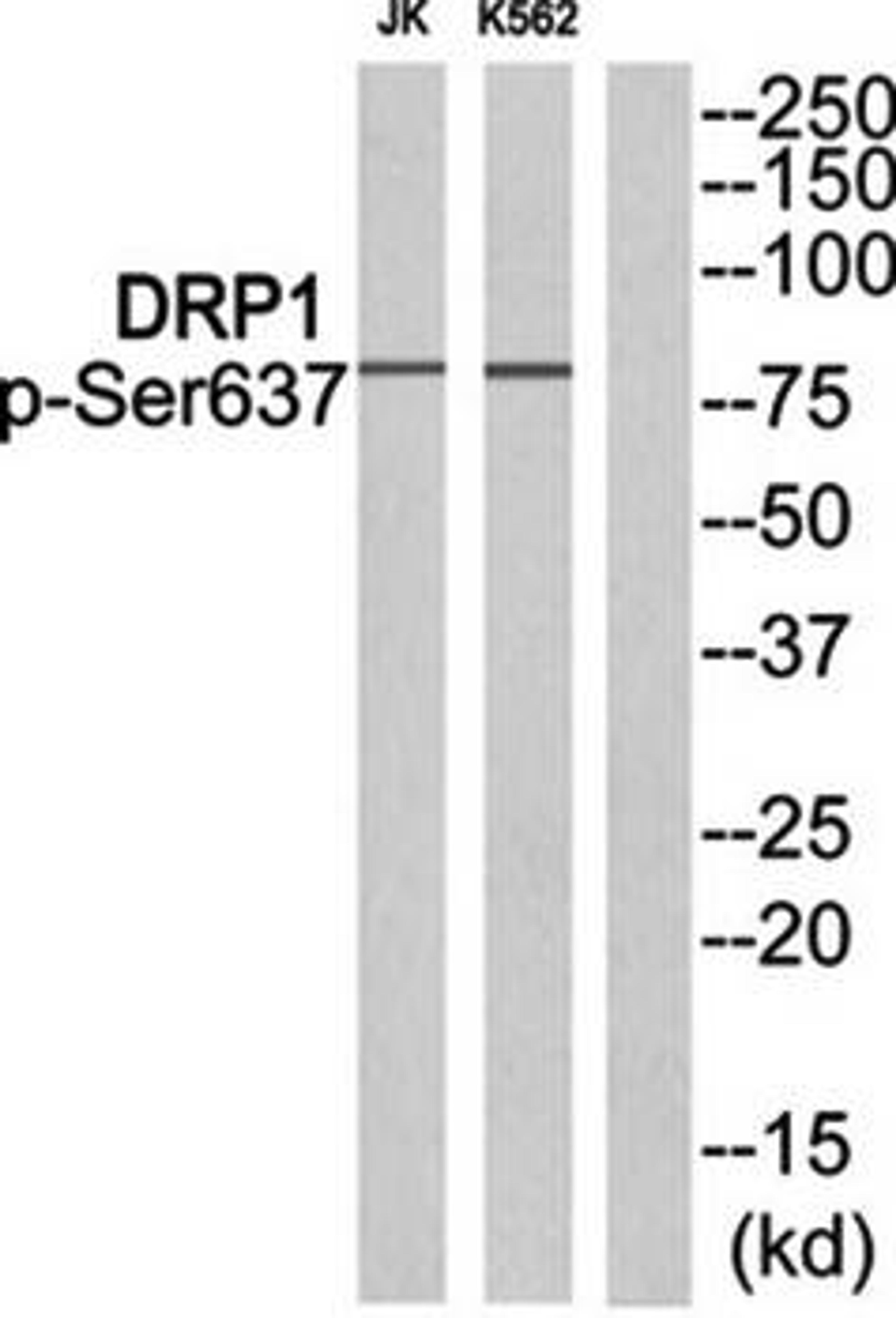 Western blot analysis of extracts from JK cells and K562 cells using DRP1 (phospho-Ser637) antibody