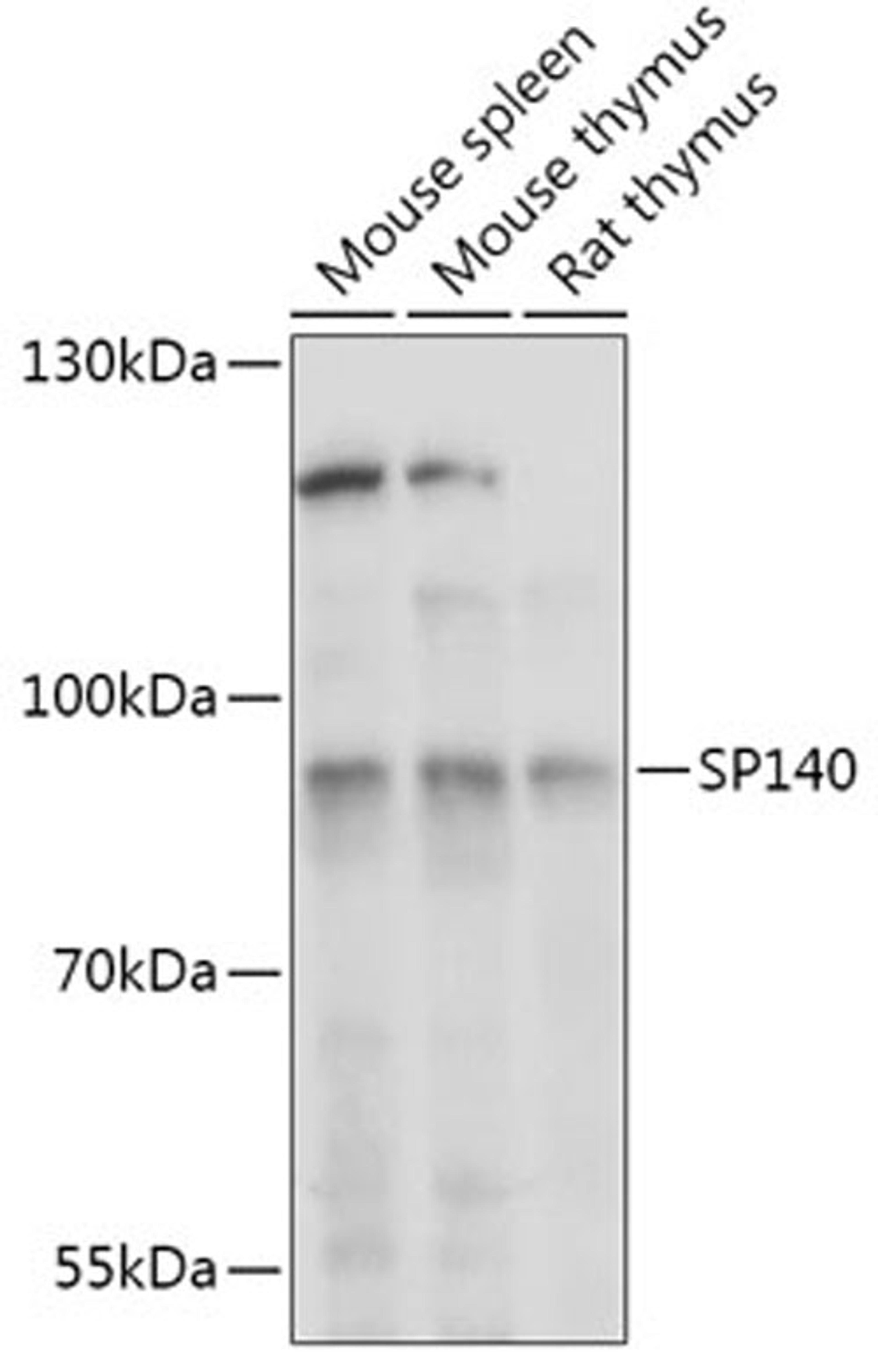 Western blot - SP140 antibody (A17634)