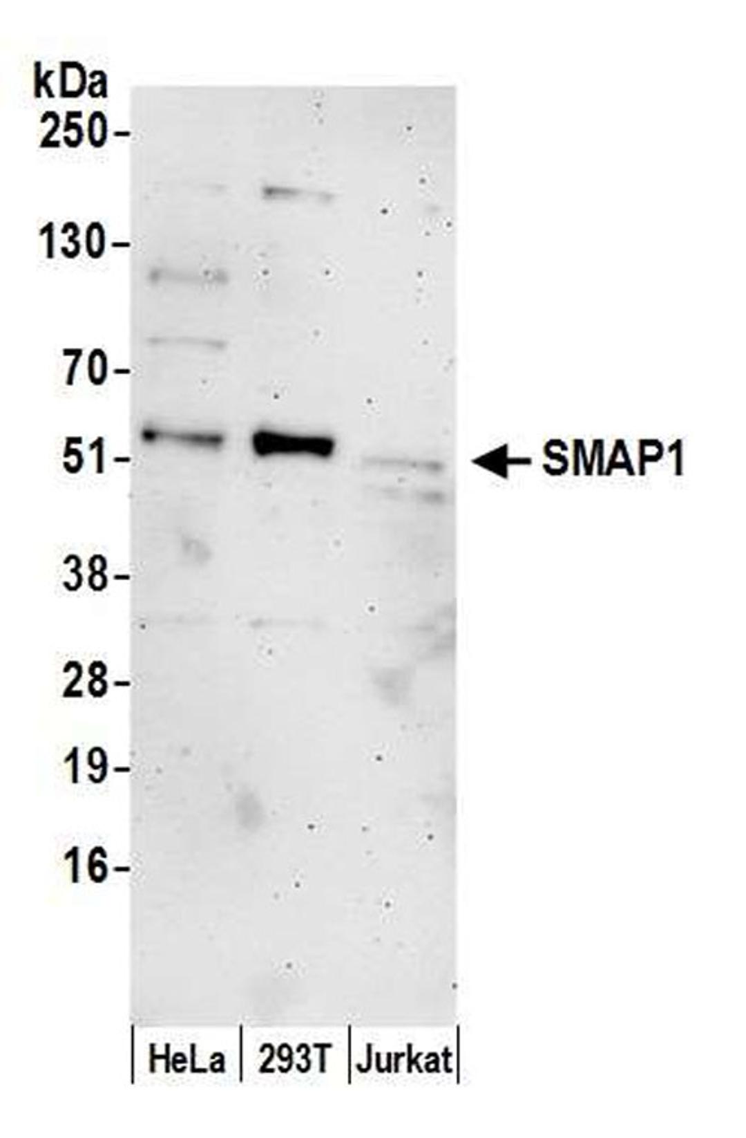 Detection of human SMAP1 by WB.