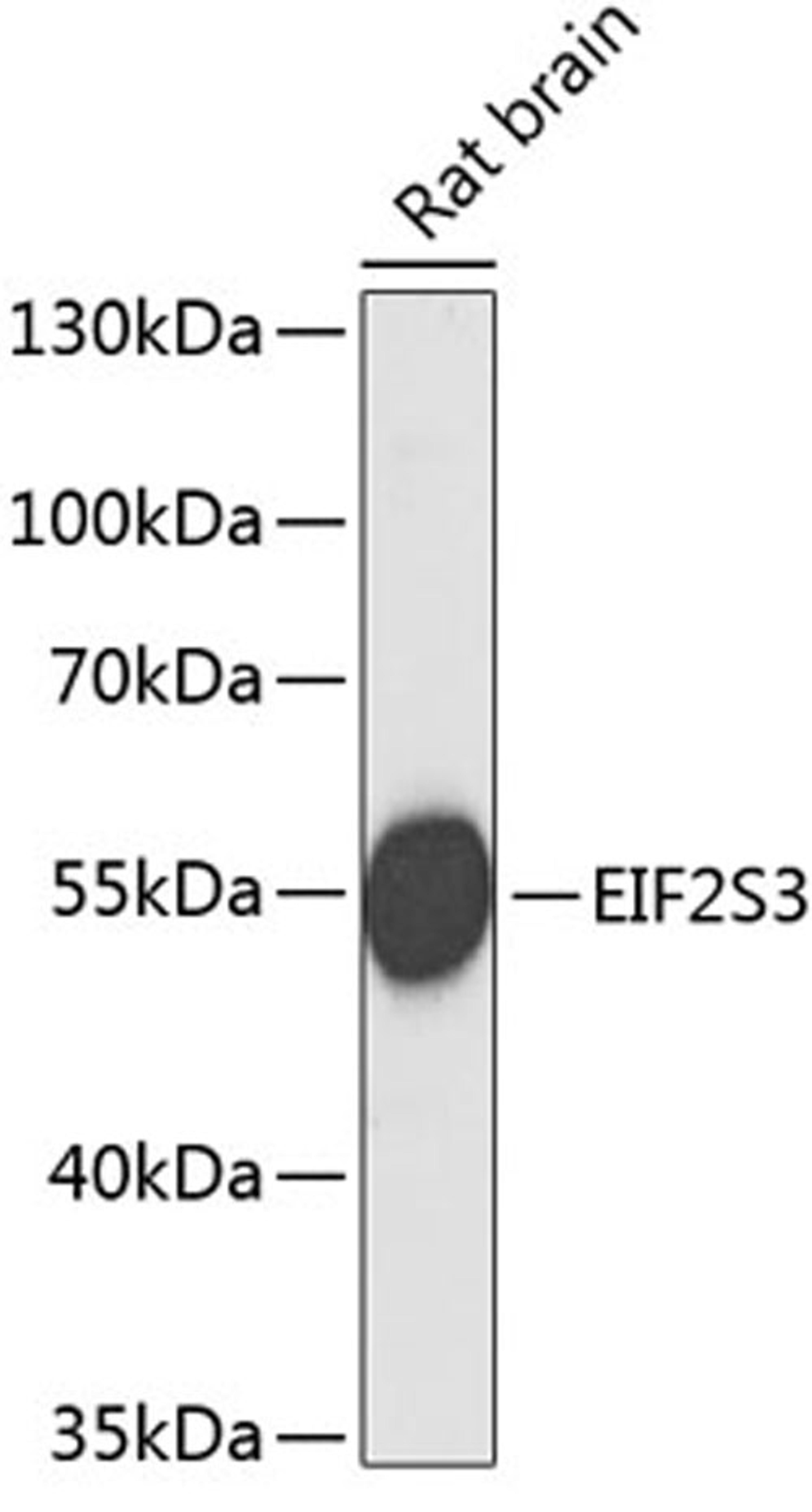 Western blot - EIF2S3 antibody (A3848)