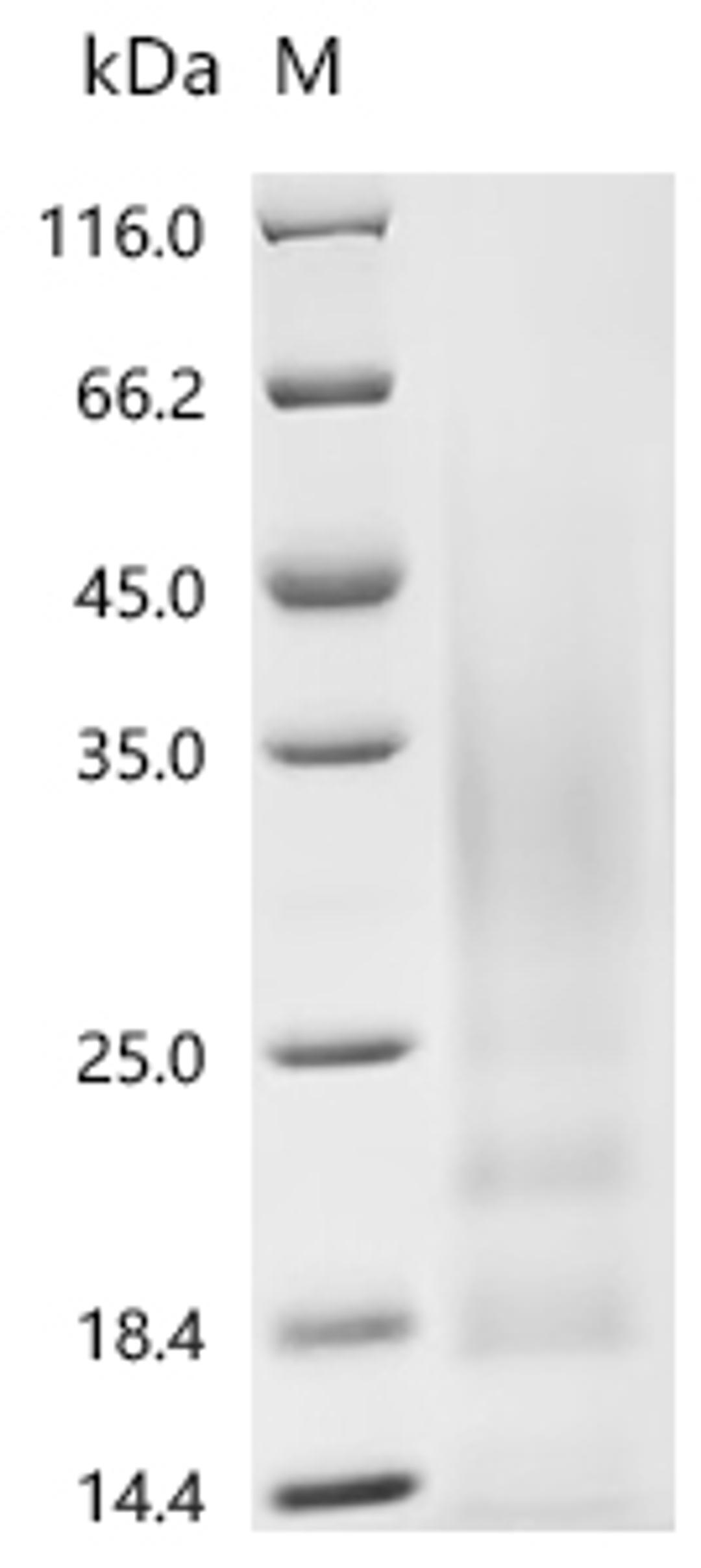 (Tris-Glycine gel) Discontinuous SDS-PAGE (reduced) with 5% enrichment gel and 15% separation gel.