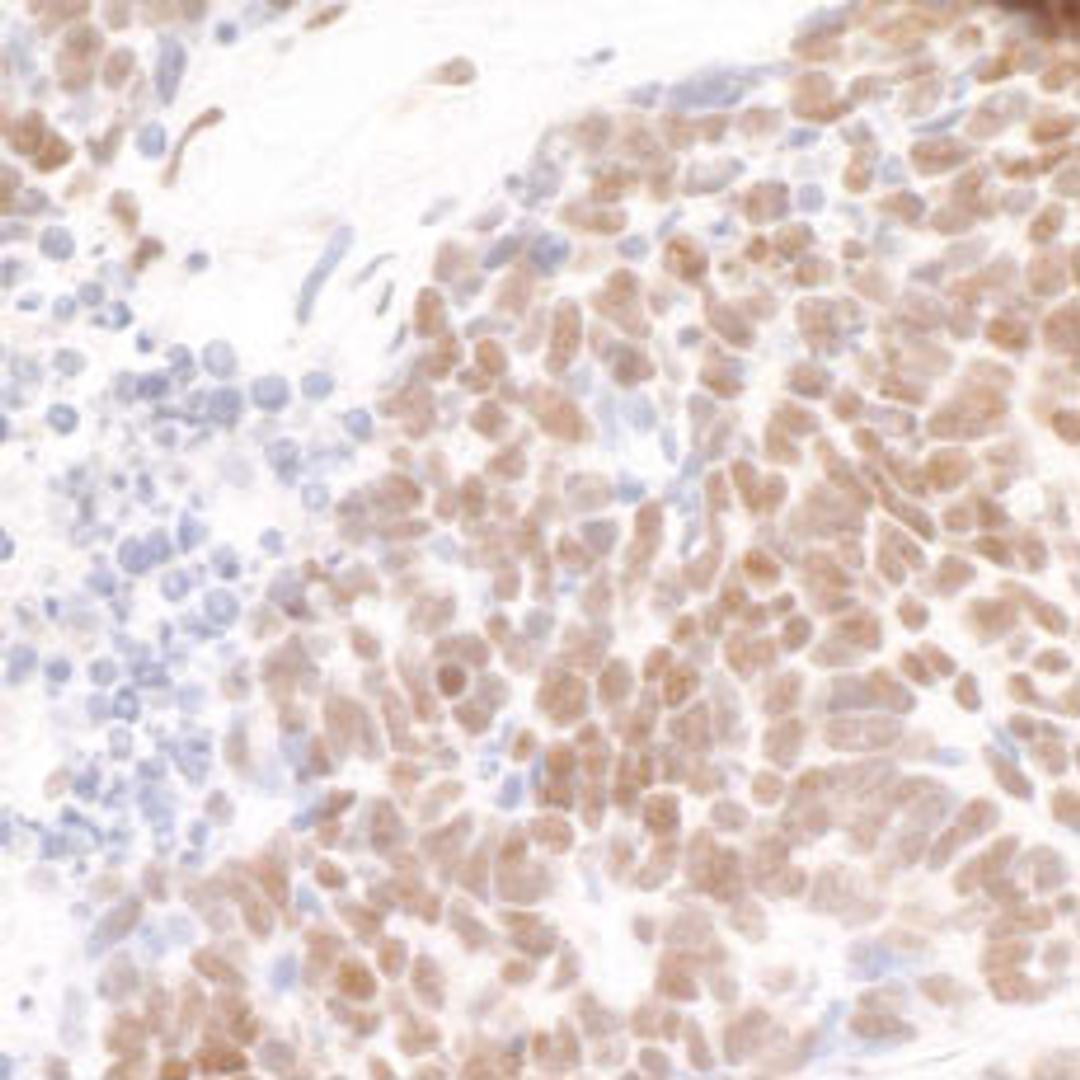 Detection of human Pds5B by immunohistochemistry.