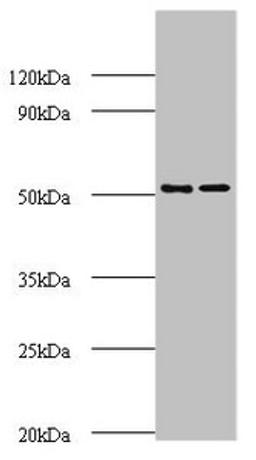 Western blot. All lanes: AP-2 complex subunit mu polyclonal Antibody at 2ug/ml. Lane 1: Mouse brain tissue. Lane 2: Rat brain tissue. Secondary. Goat polyclonal to rabbit IgG at 1/10000 dilution. Predicted band size: 50 kDa. Observed band size: 50 kDa. 