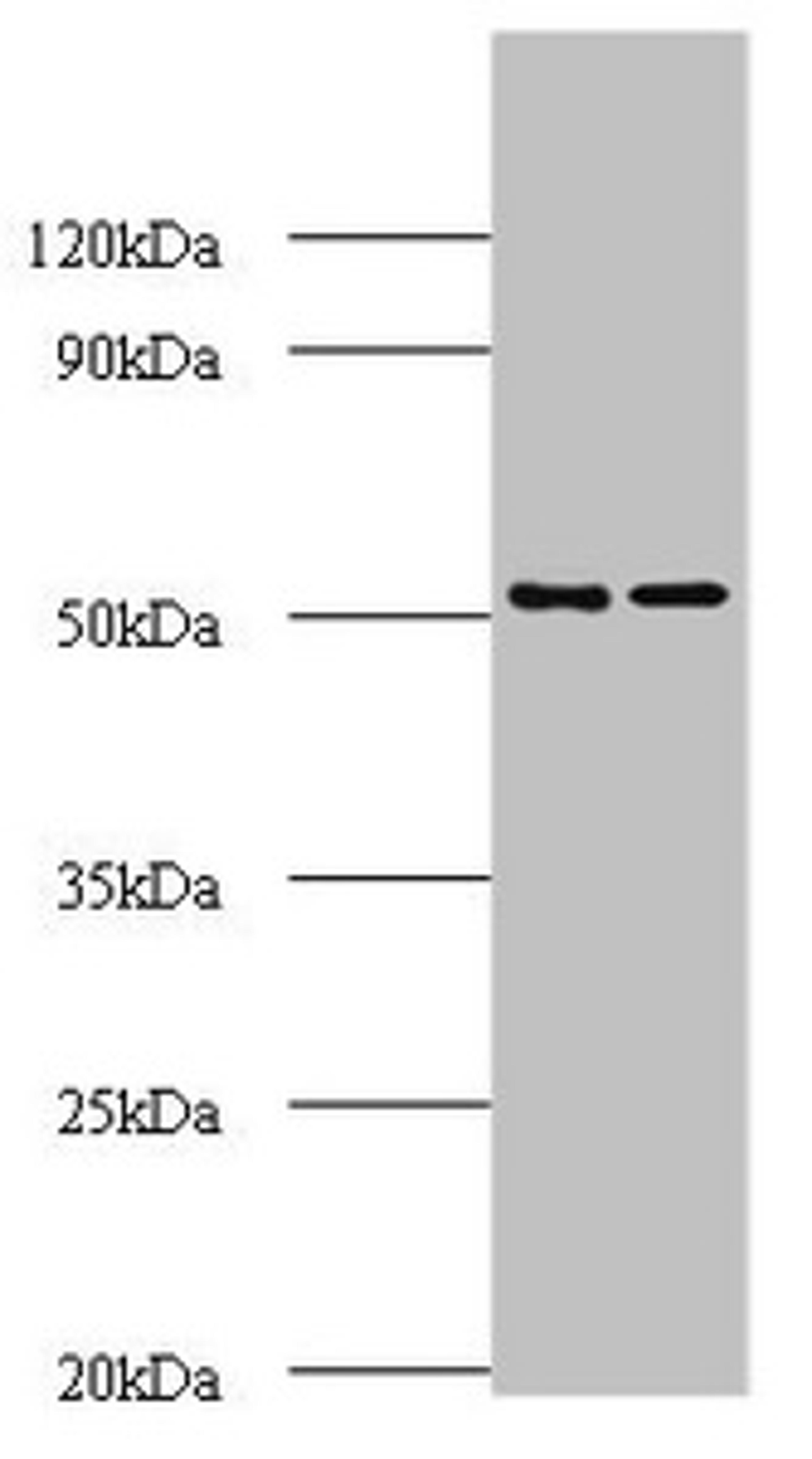 Western blot. All lanes: AP-2 complex subunit mu polyclonal Antibody at 2ug/ml. Lane 1: Mouse brain tissue. Lane 2: Rat brain tissue. Secondary. Goat polyclonal to rabbit IgG at 1/10000 dilution. Predicted band size: 50 kDa. Observed band size: 50 kDa. 