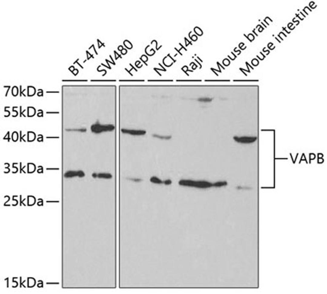 Western blot - VAPB antibody (A5363)