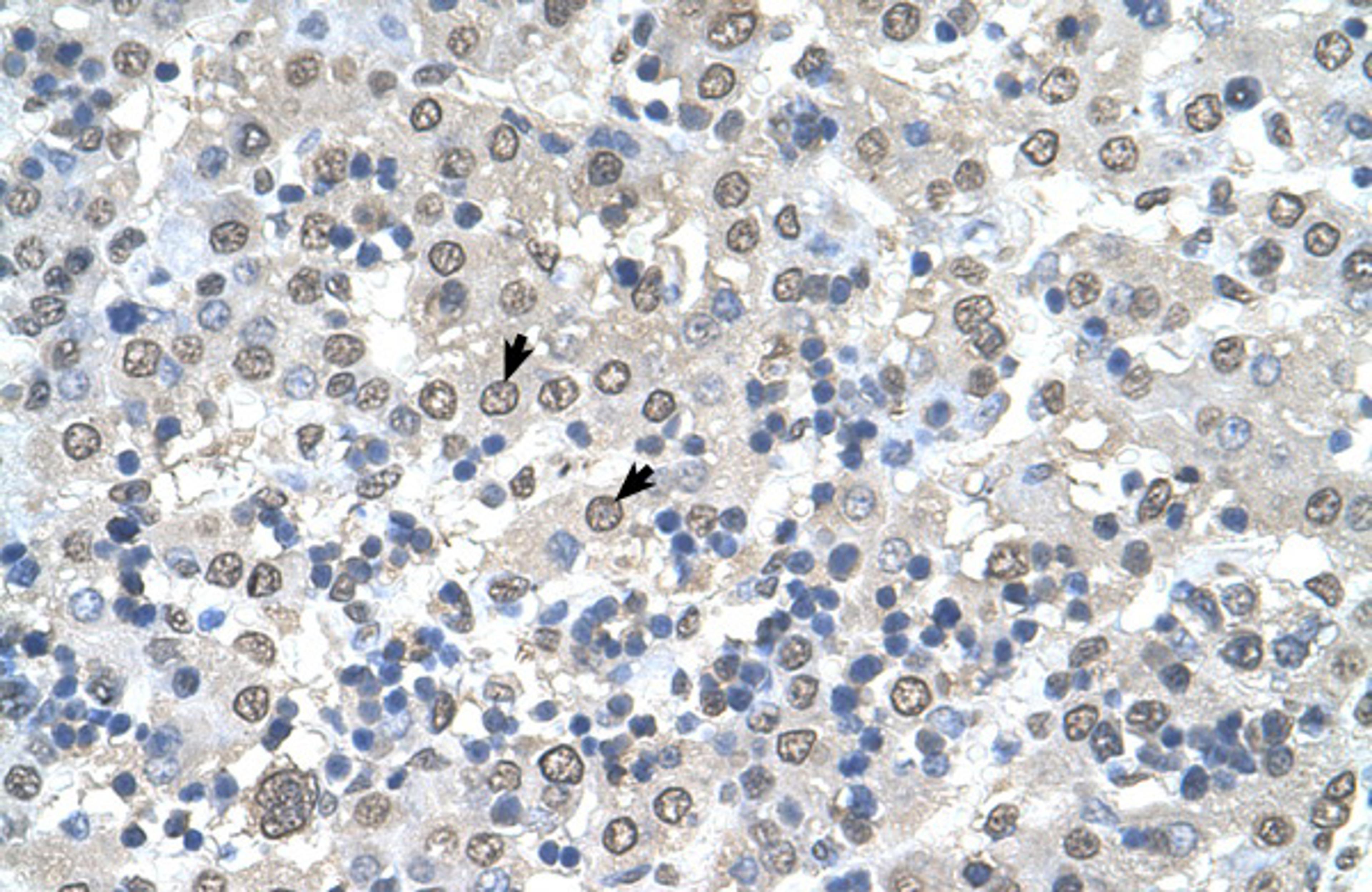 Antibody used in IHC on Human Liver.