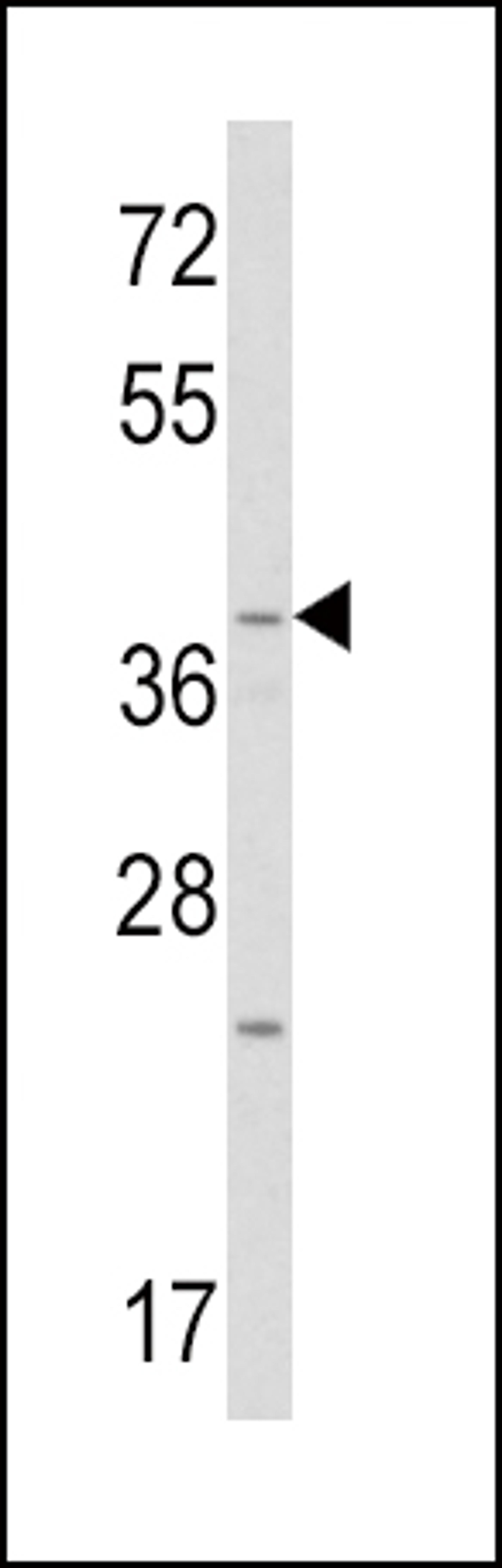 Western blot analysis of WNT1 Antibody in mouse heart tissue lysates (35ug/lane)