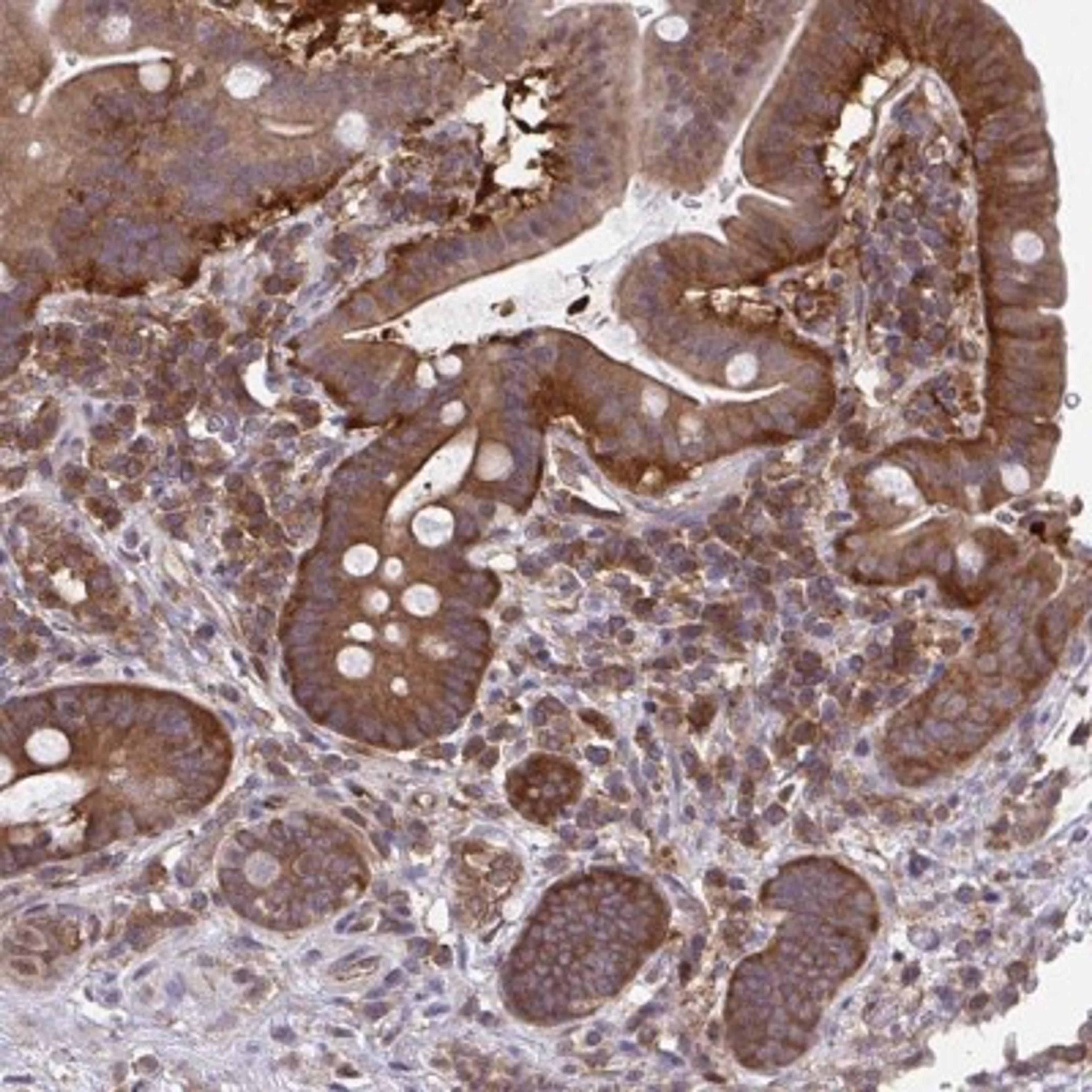 Immunohistochemistry: ALDH16A1 Antibody [NBP2-31774] - Staining of human small intestine shows strong cytoplasmic positivity in glandular cells.