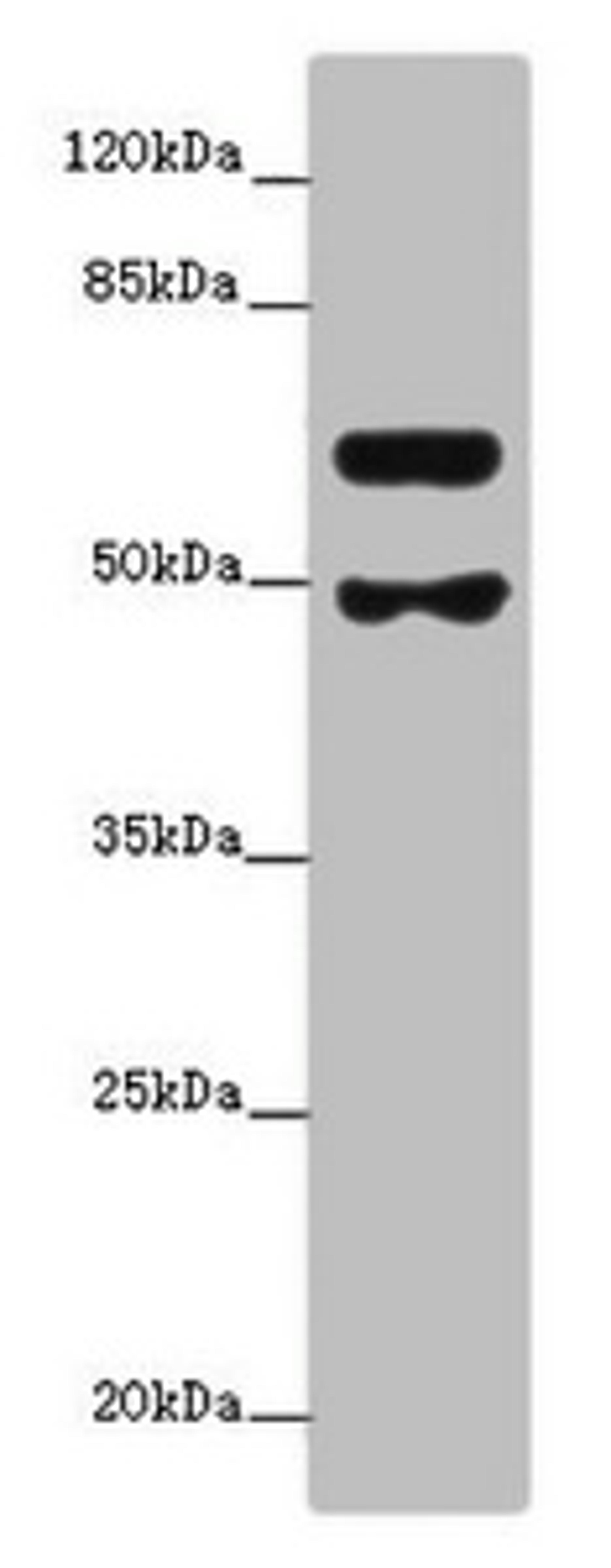 Western blot. All lanes: GALNT16 antibody at 1:500 + Mouse kidney tissue. Secondary. Goat polyclonal to rabbit at 1/10000 dilution. Predicted band size: 64, 61 kDa. Observed band size: 64, 49 kDa. 