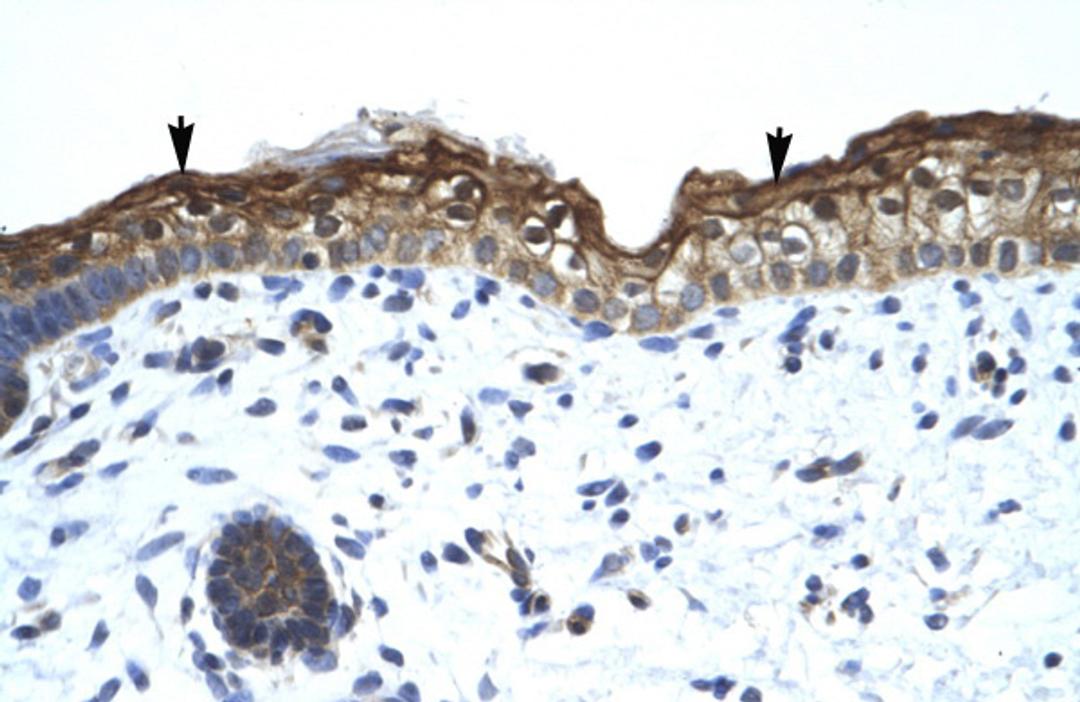 Antibody used in IHC on Human Skin.