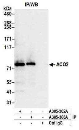 Detection of human ACO2 by western blot of immunoprecipitates.