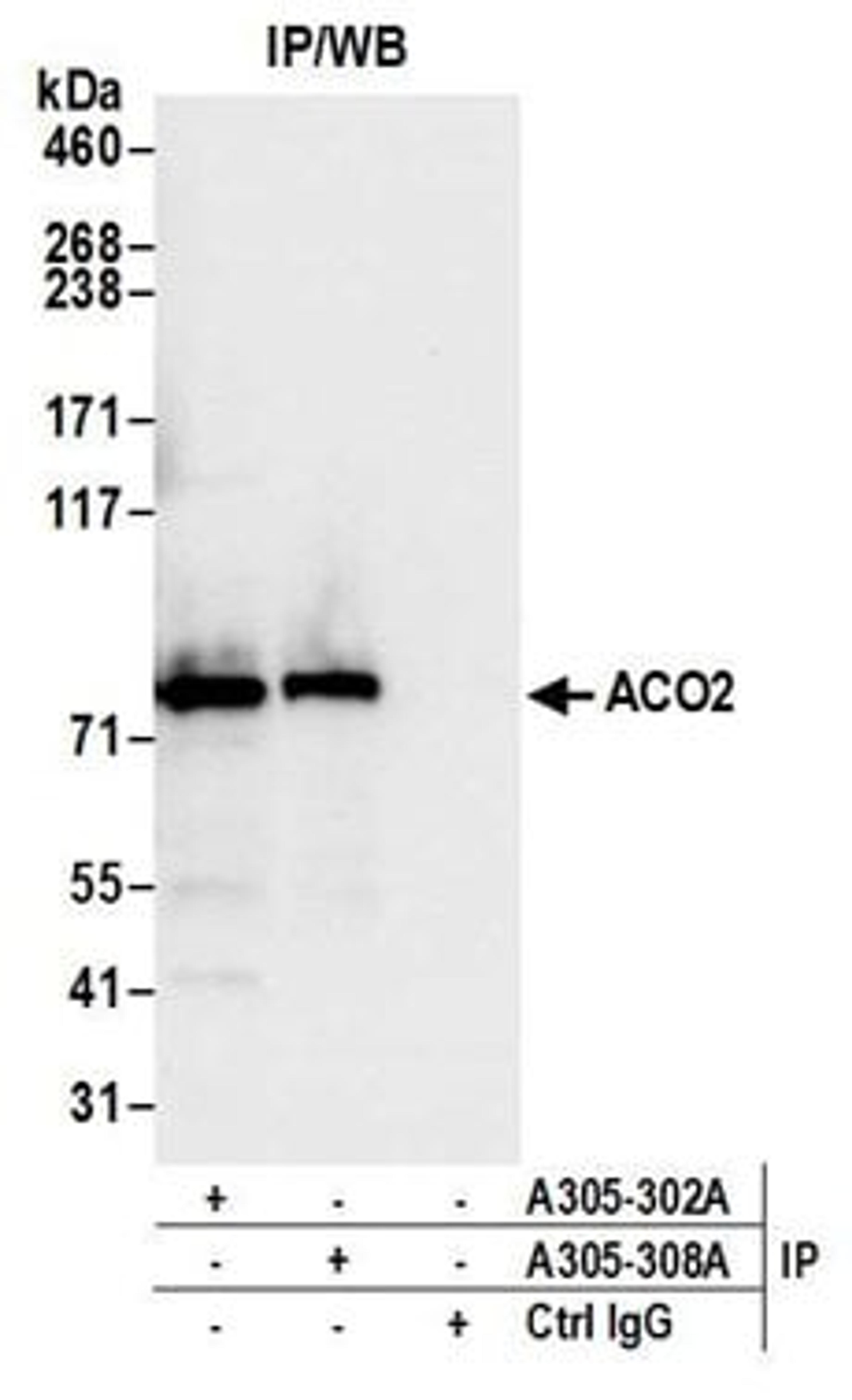 Detection of human ACO2 by western blot of immunoprecipitates.